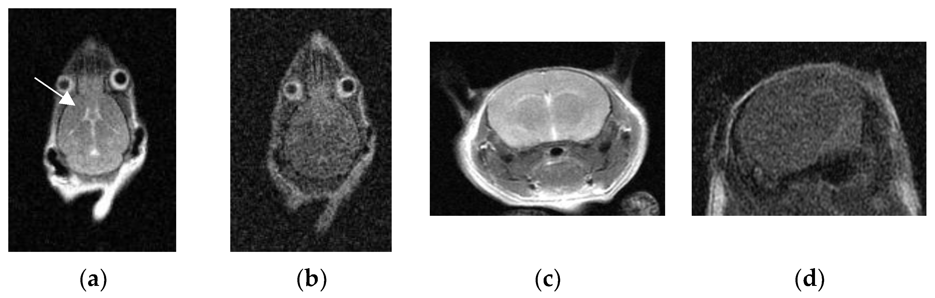 Tomography 10 00064 g004