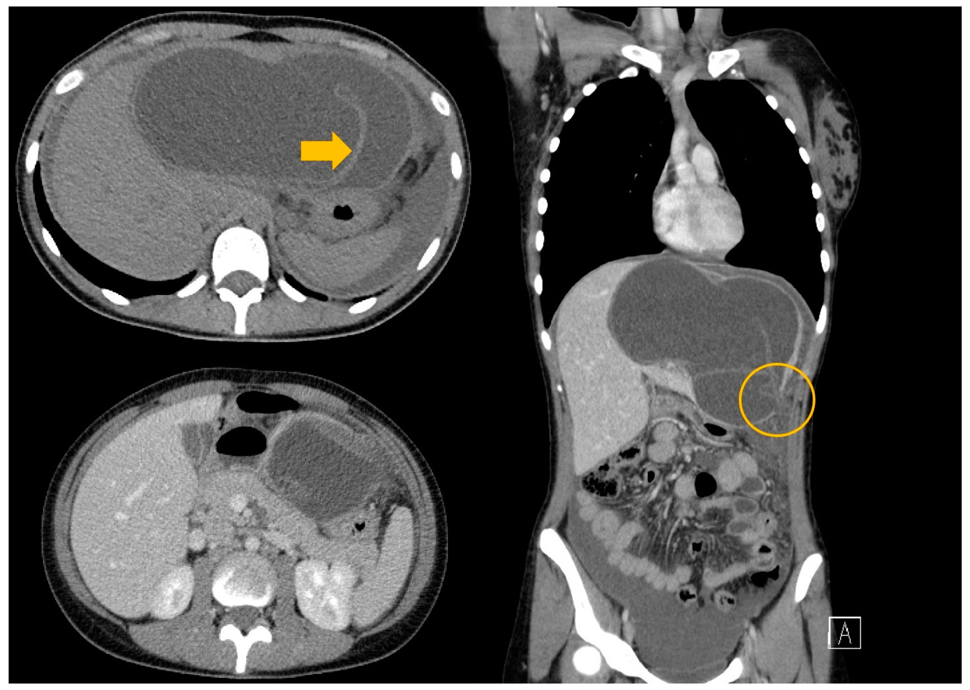 Tomography 10 00070 g004