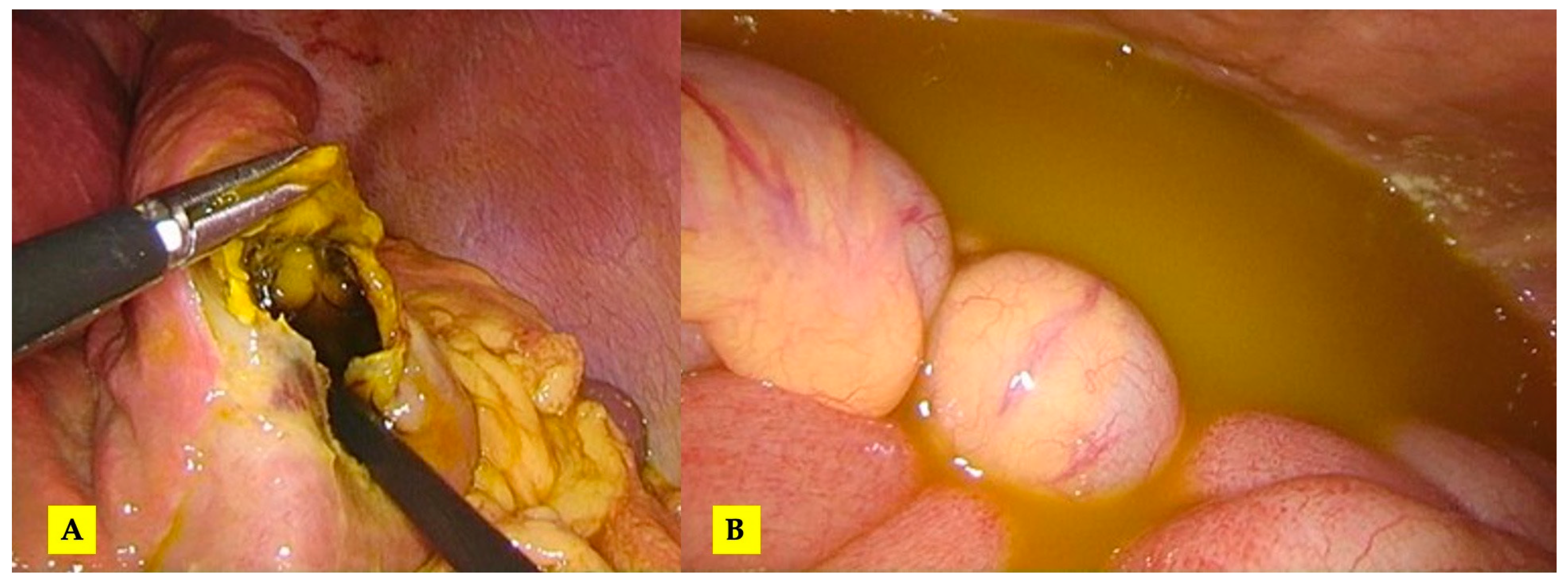 Tomography 10 00070 g005