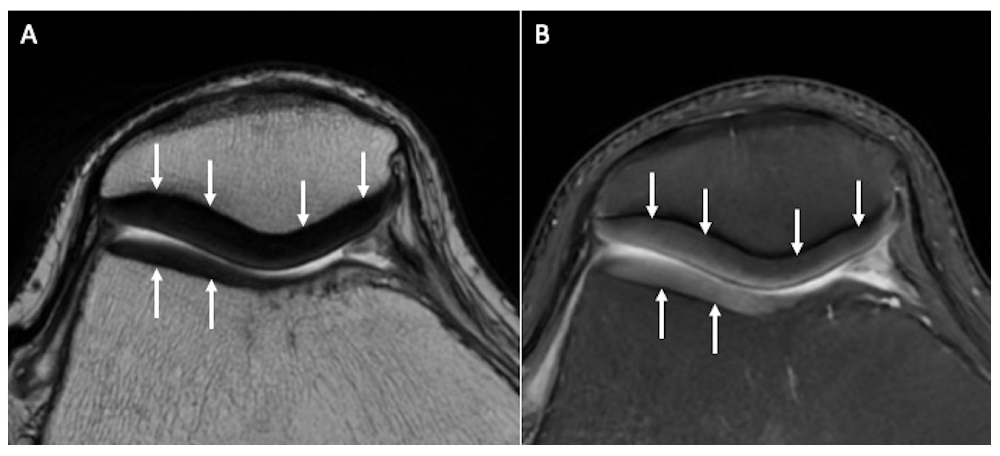 Tomography 10 00072 g001 Tomography 10 00072 g001