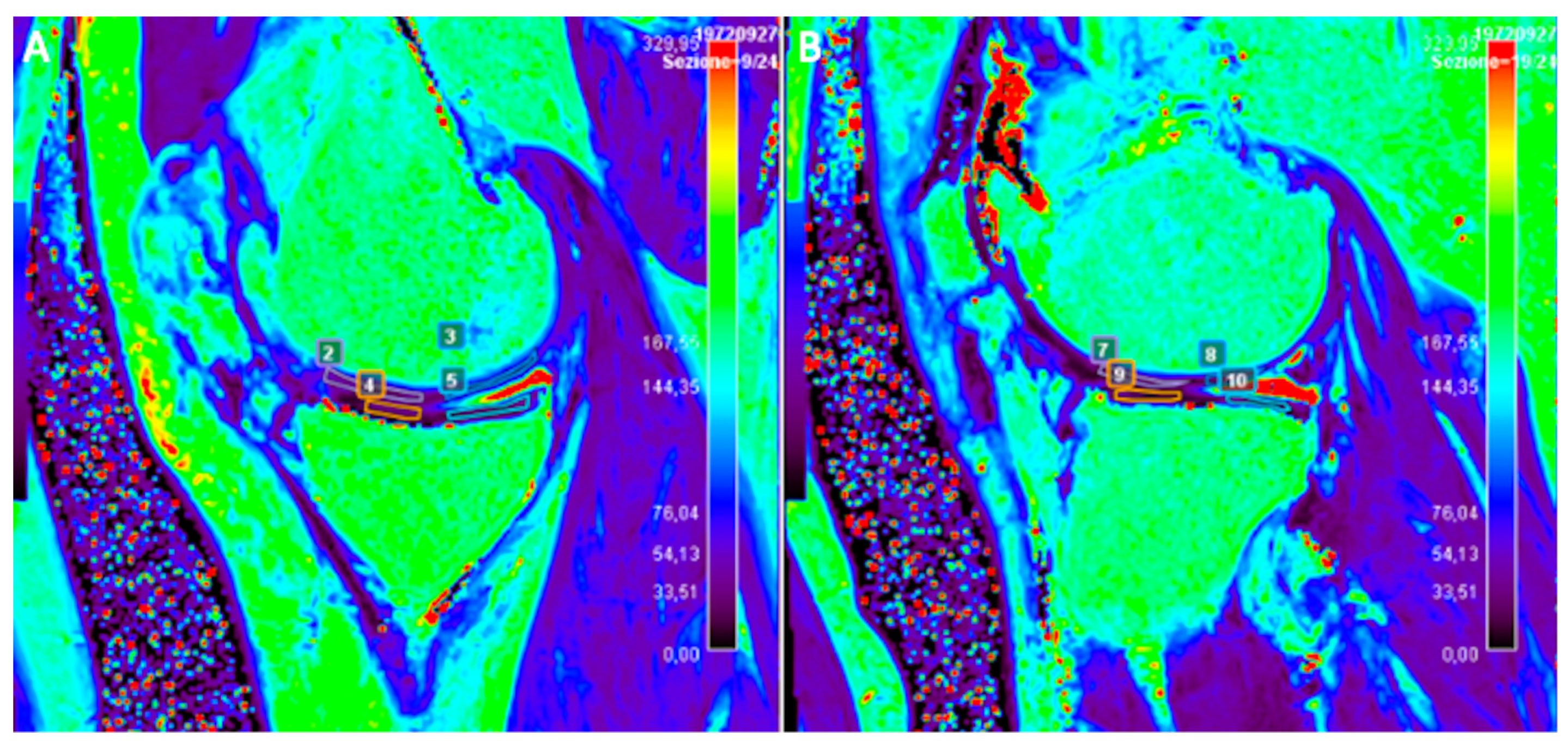Tomography 10 00072 g005 Tomography 10 00072 g005