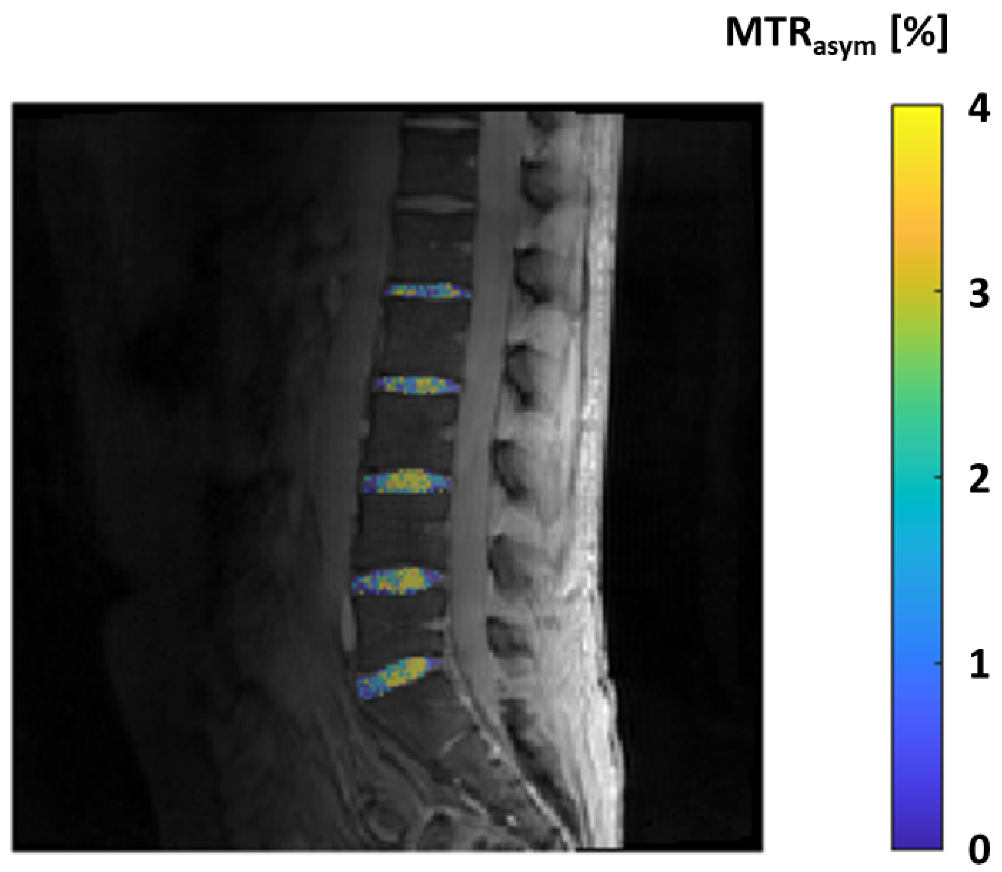 Tomography 10 00072 g008 Tomography 10 00072 g008