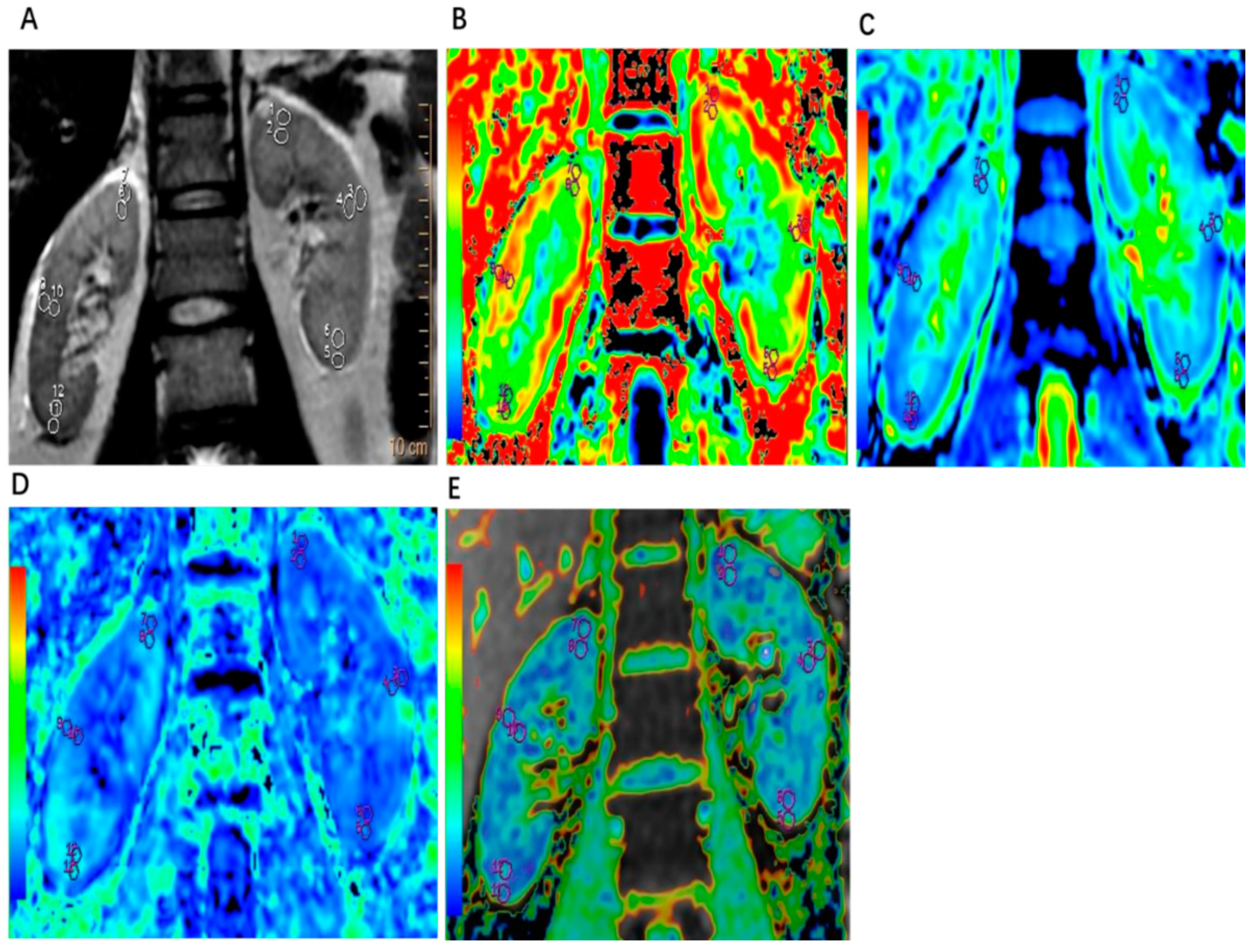 Tomography 10 00073 g001