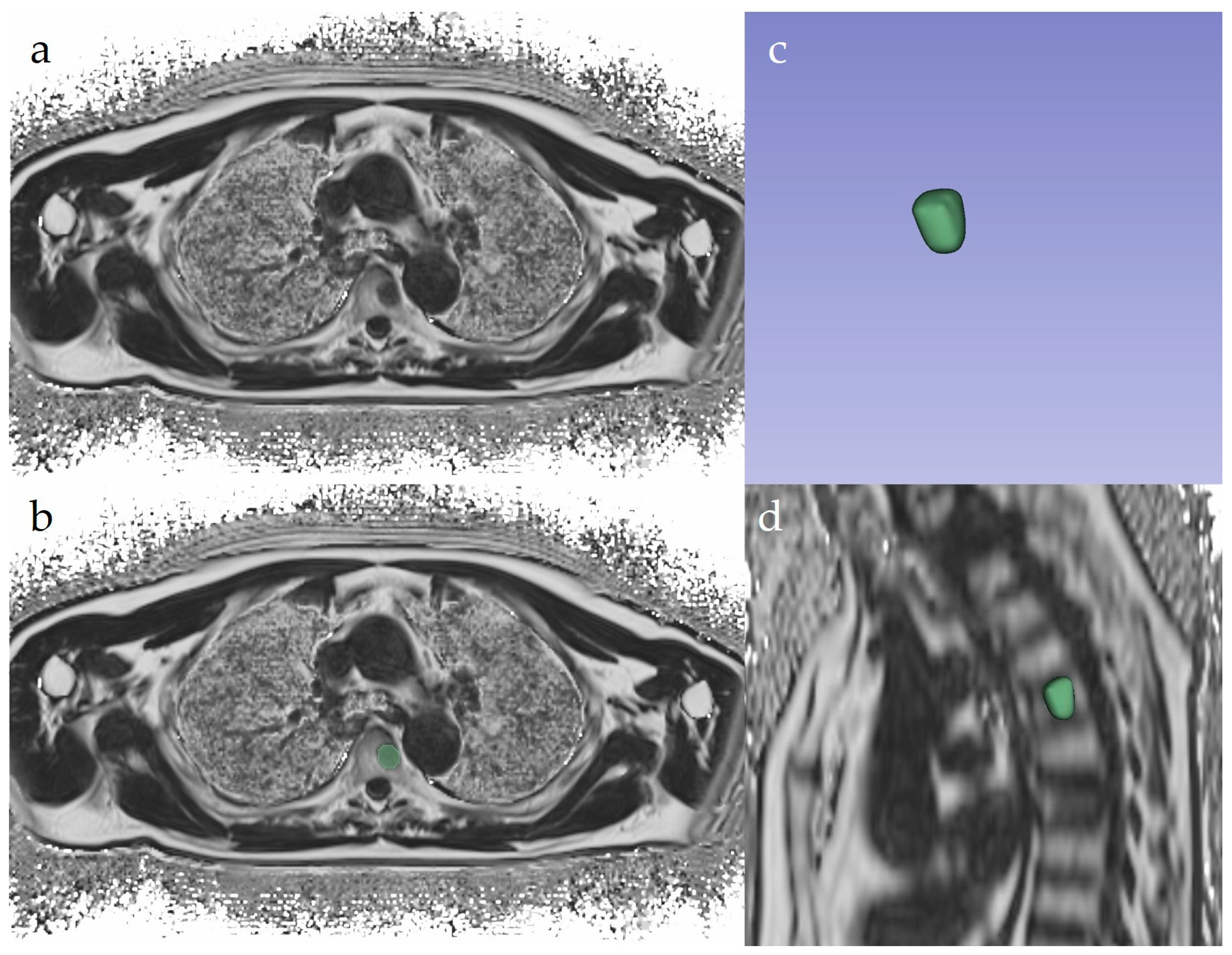 Tomography 10 00075 g001