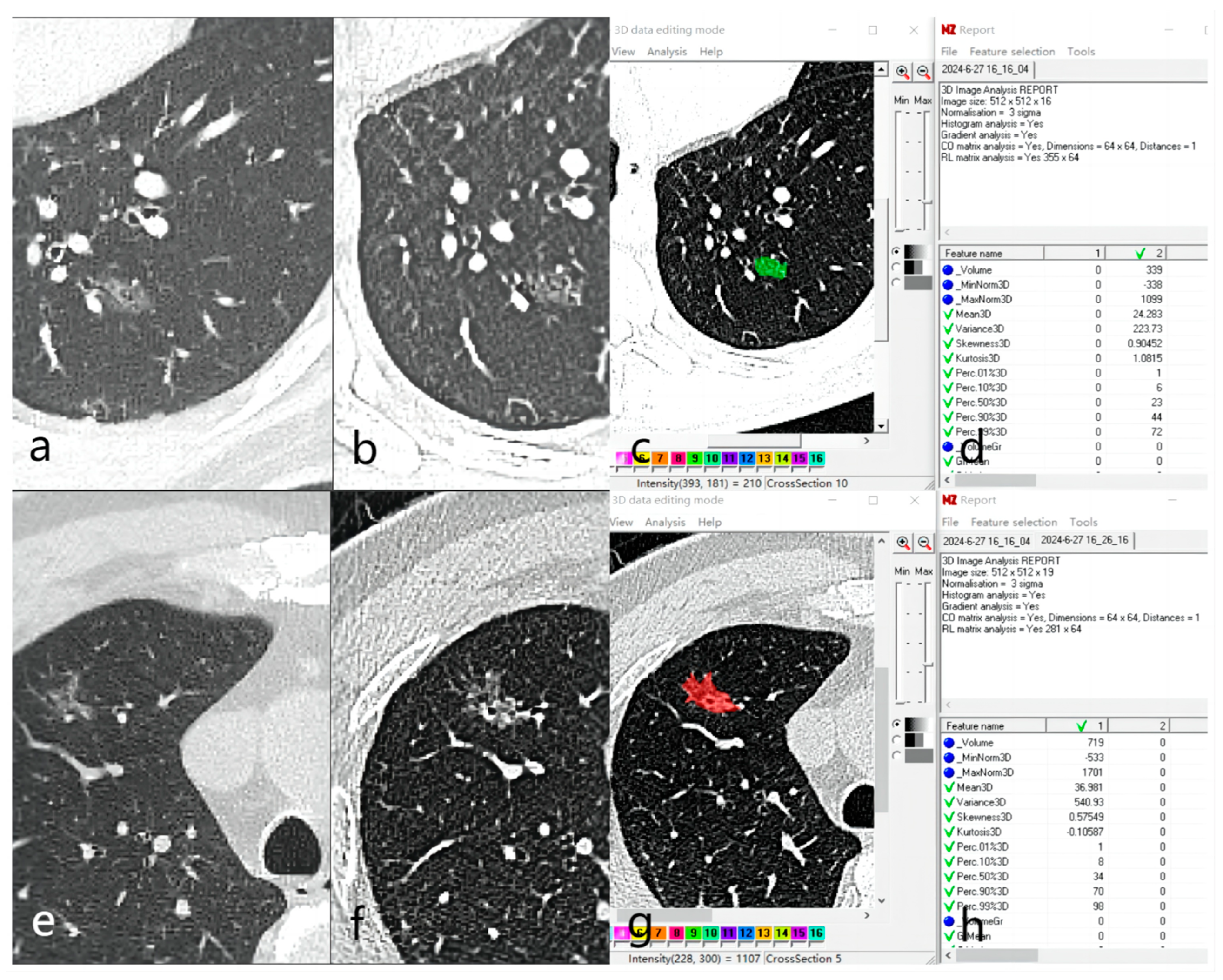 Tomography 10 00078 g002