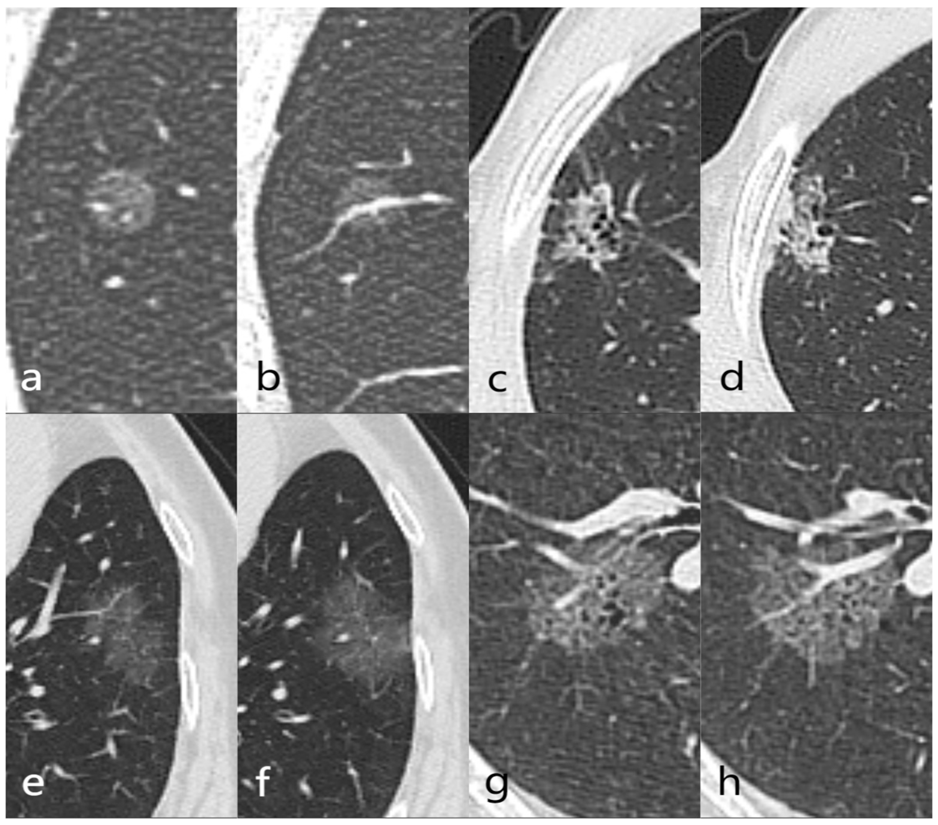 Tomography 10 00078 g006