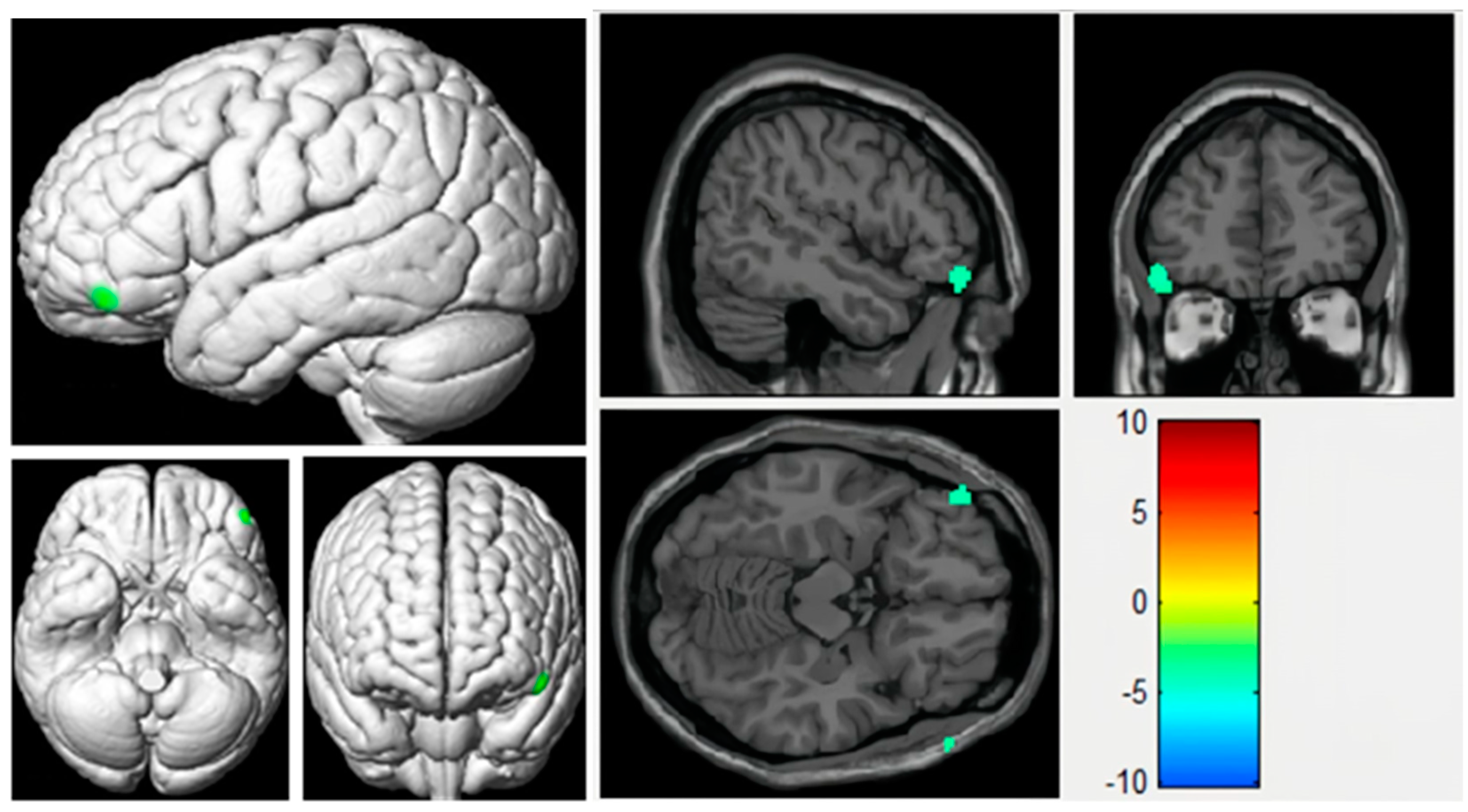 Tomography 10 00104 g006