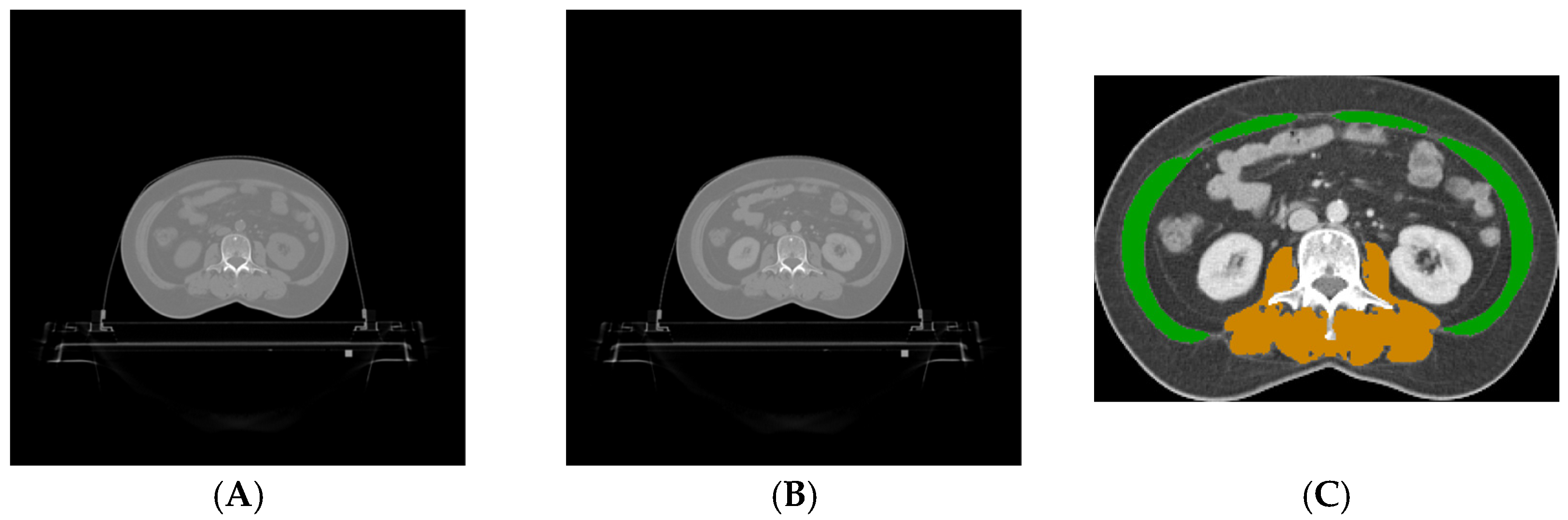 Tomography 10 00111 g001
