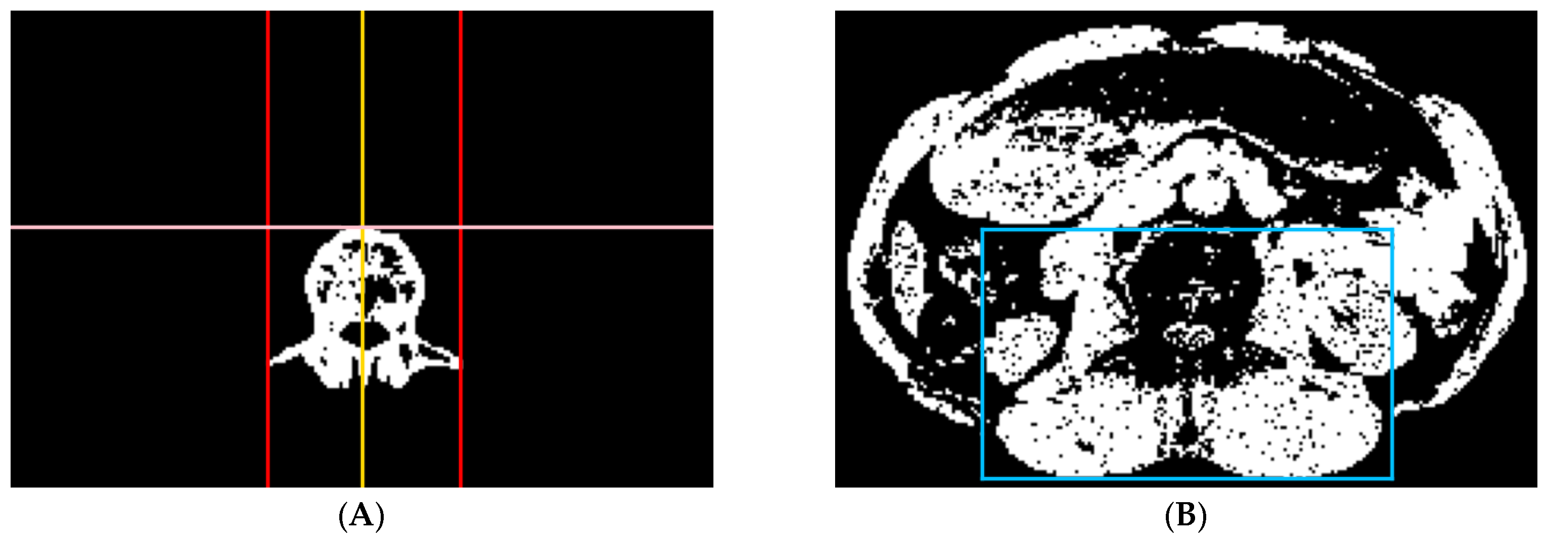 Tomography 10 00111 g007
