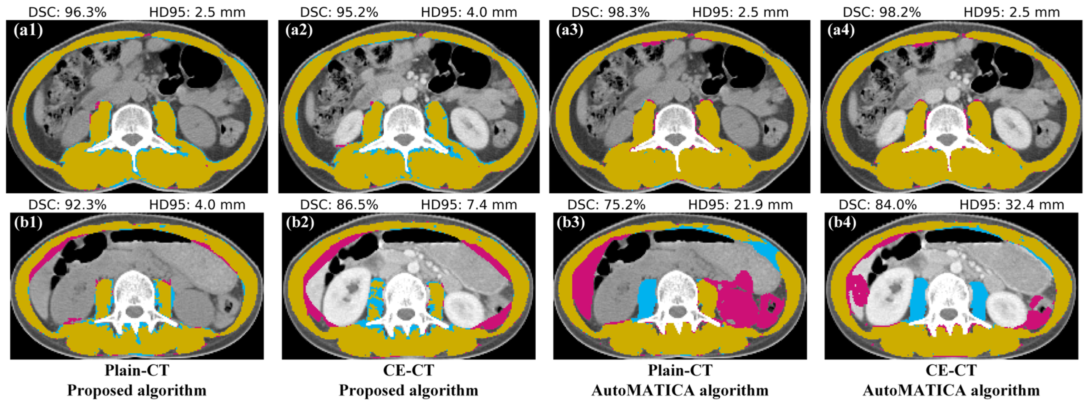 Tomography 10 00111 g010