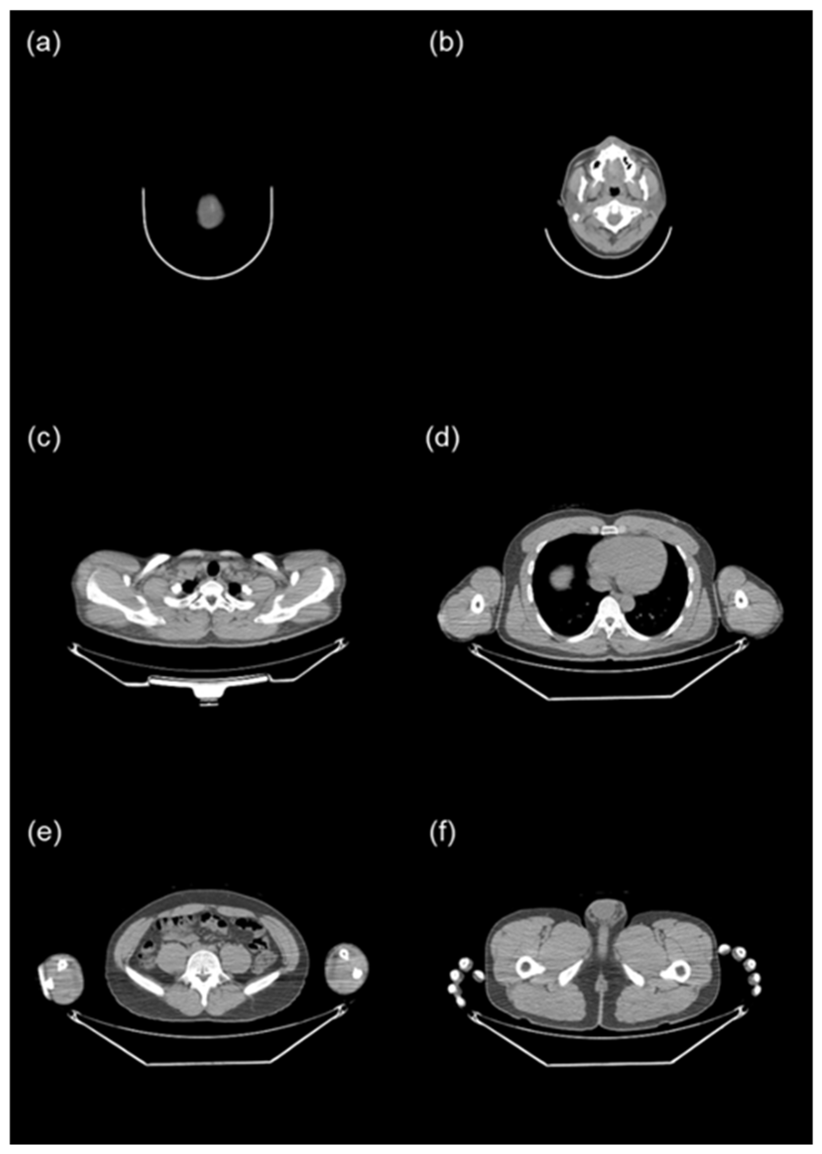 Tomography 10 00151 g002