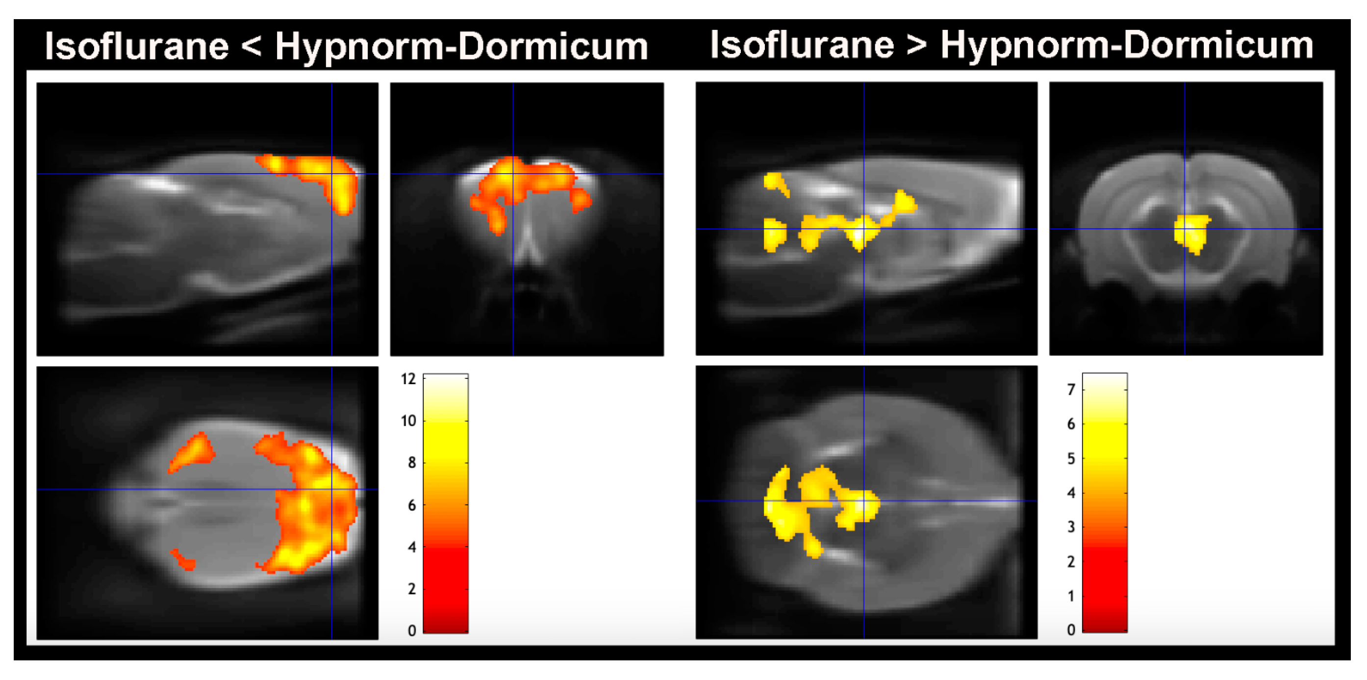 Tomography 11 00004 g004