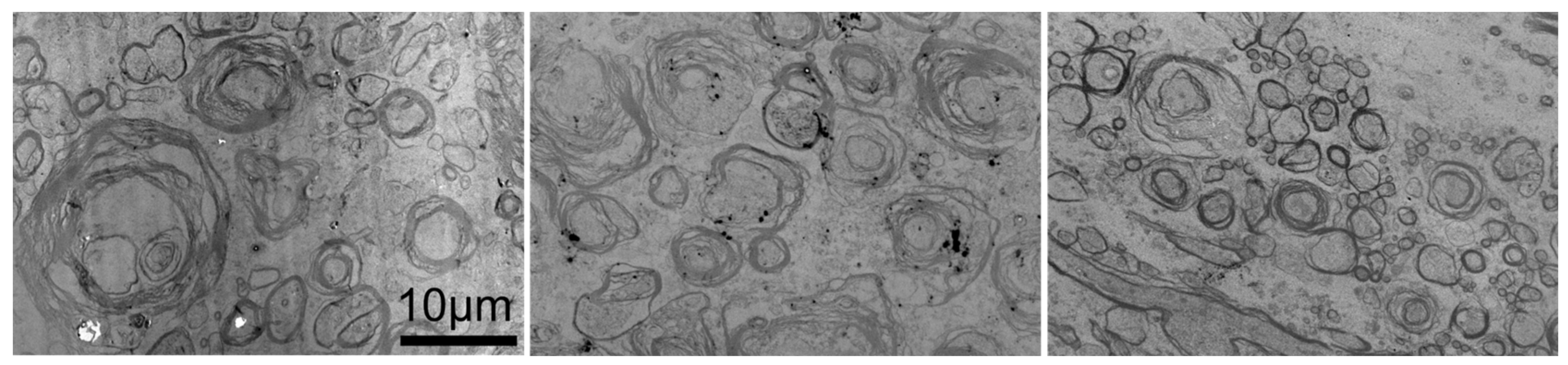 Tomography 11 00008 g005