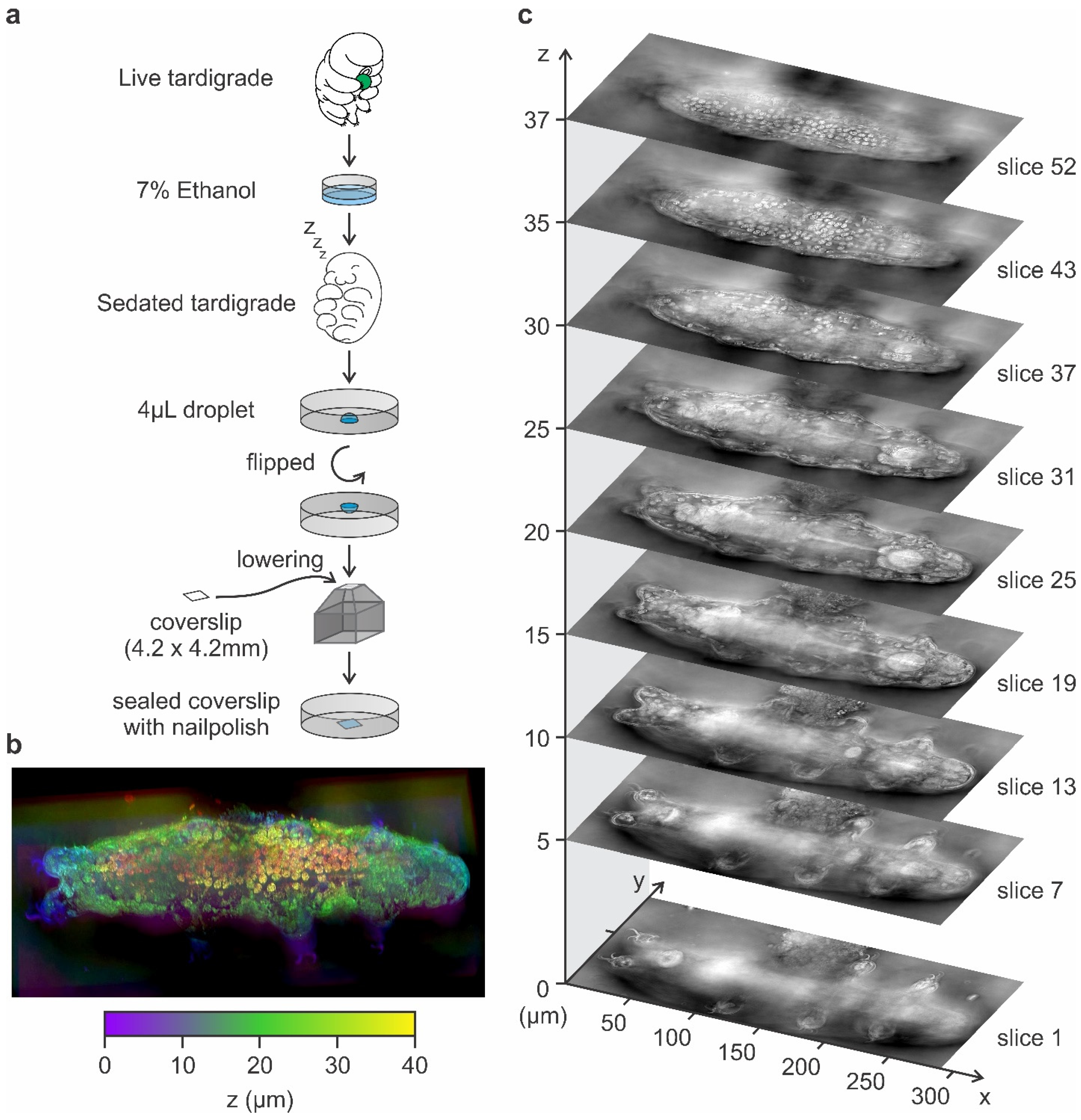 Tomography 11 00034 g002
