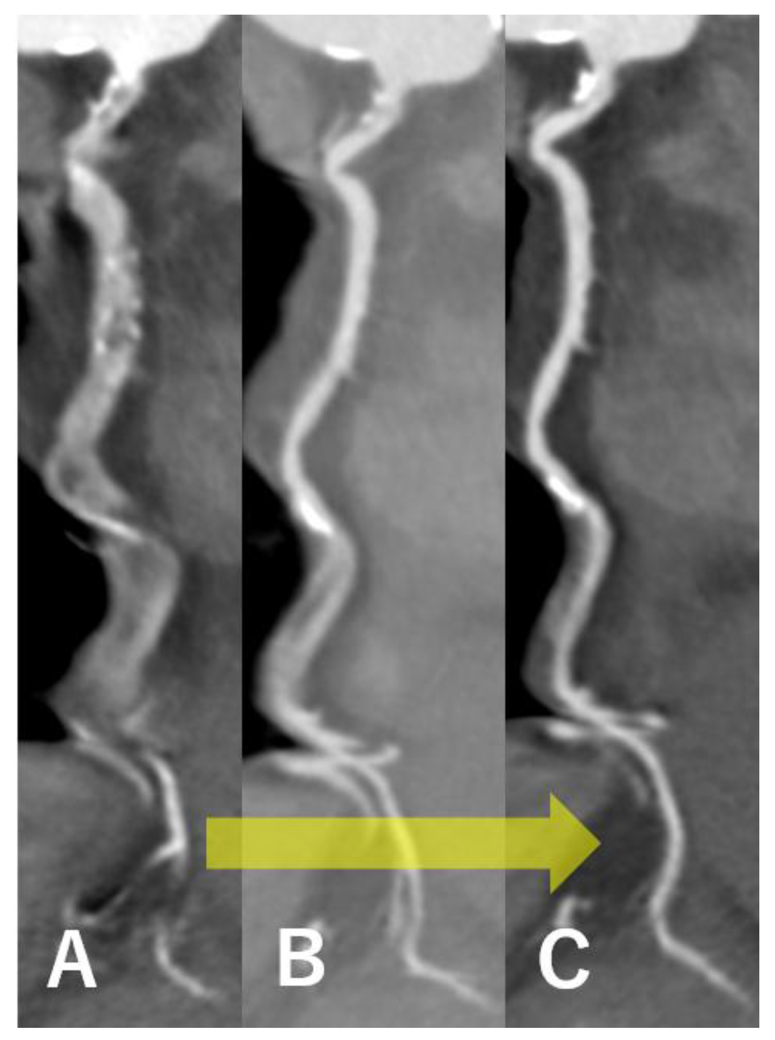 Tomography 11 00062 g001
