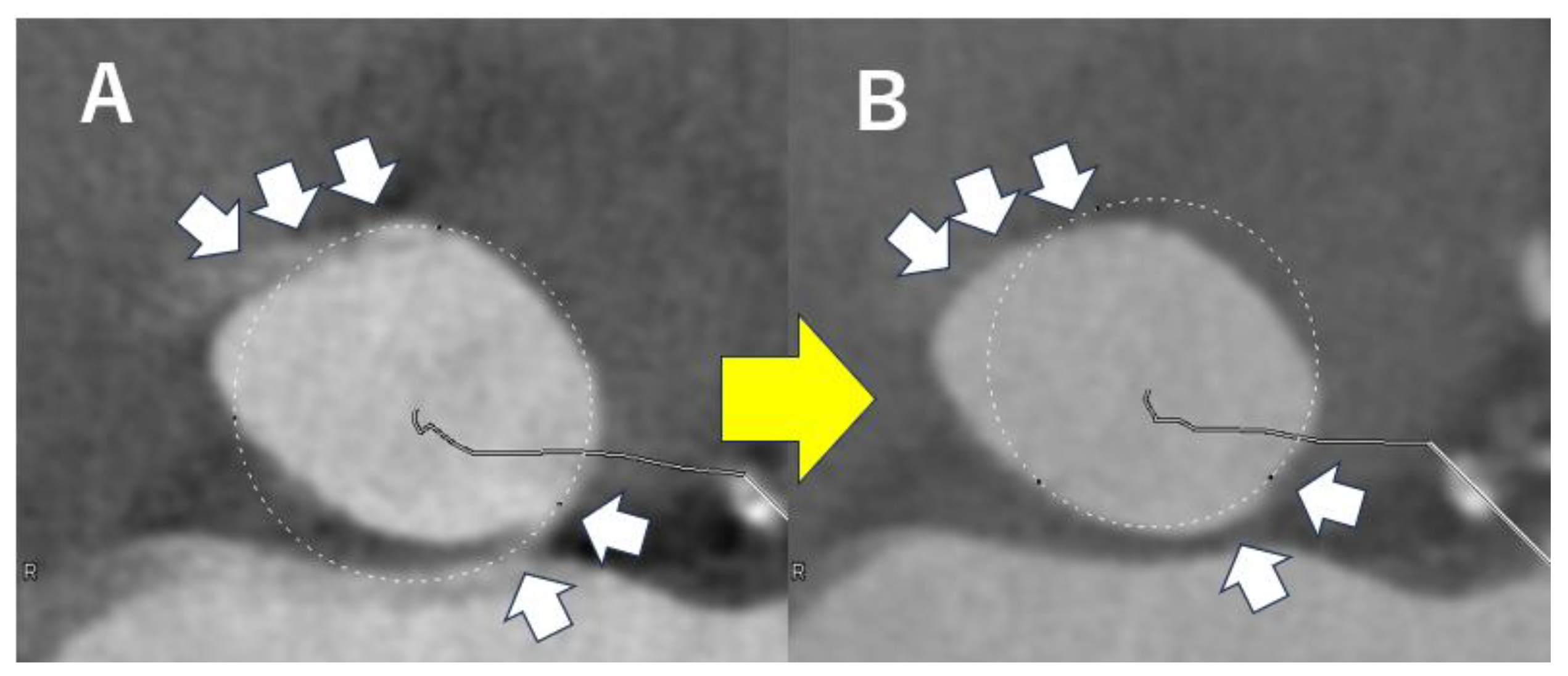 Tomography 11 00062 g003