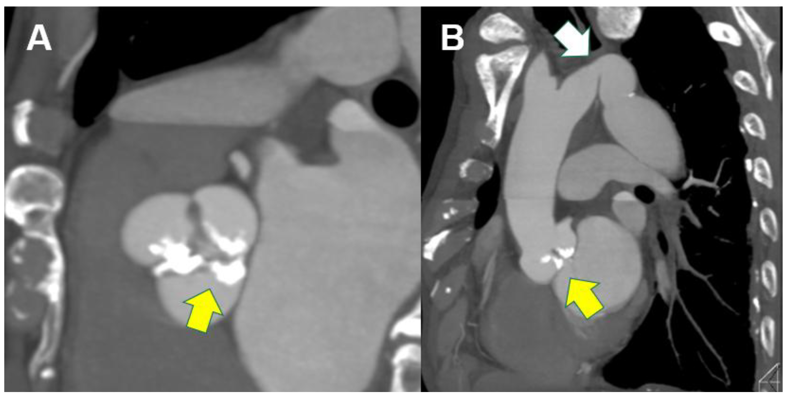 Tomography 11 00062 g004