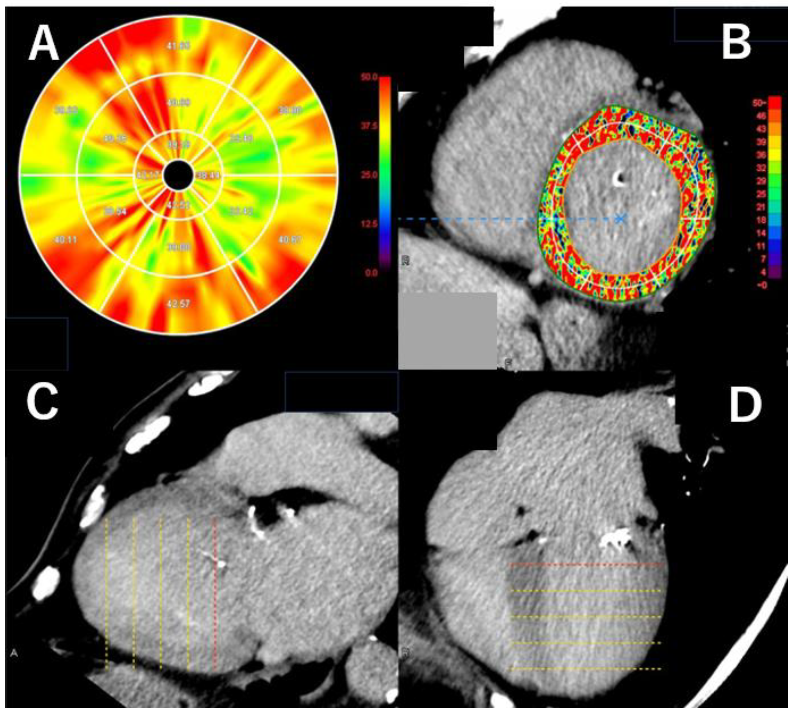 Tomography 11 00062 g005