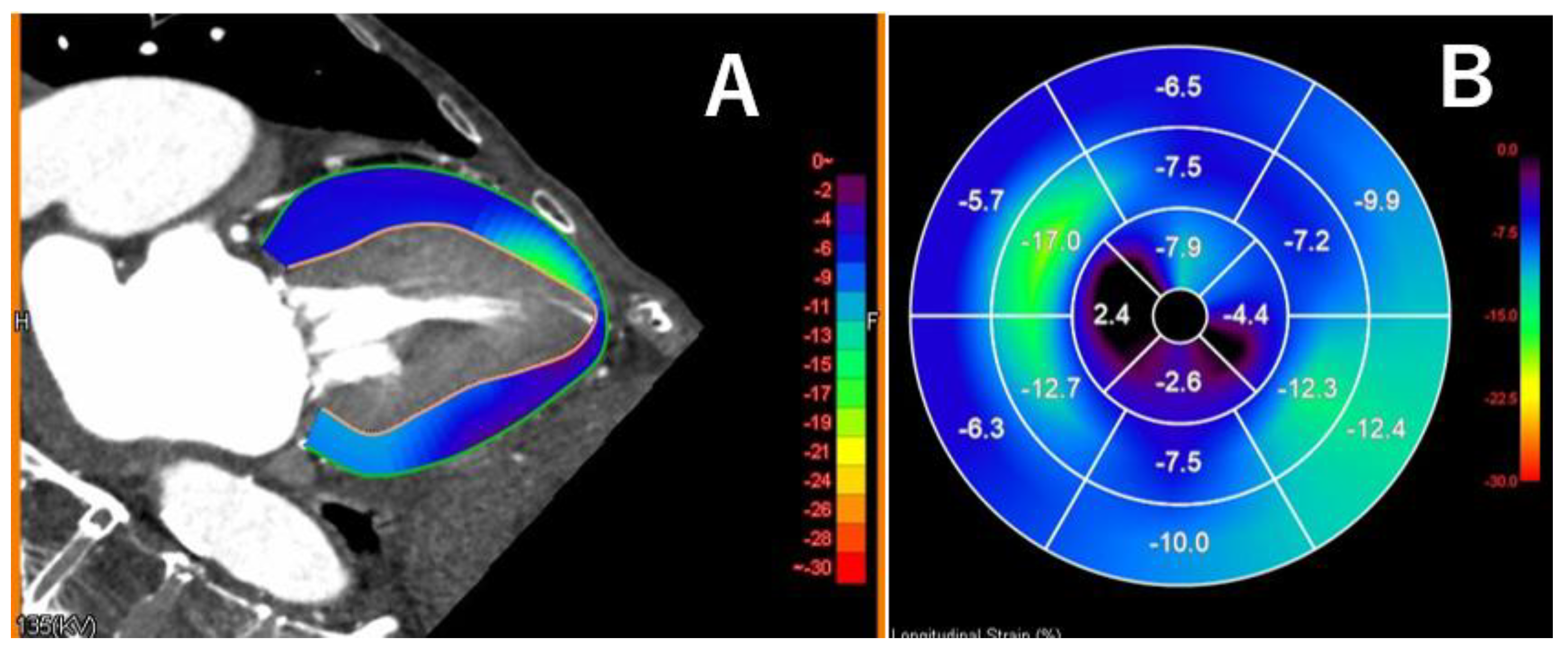 Tomography 11 00062 g006