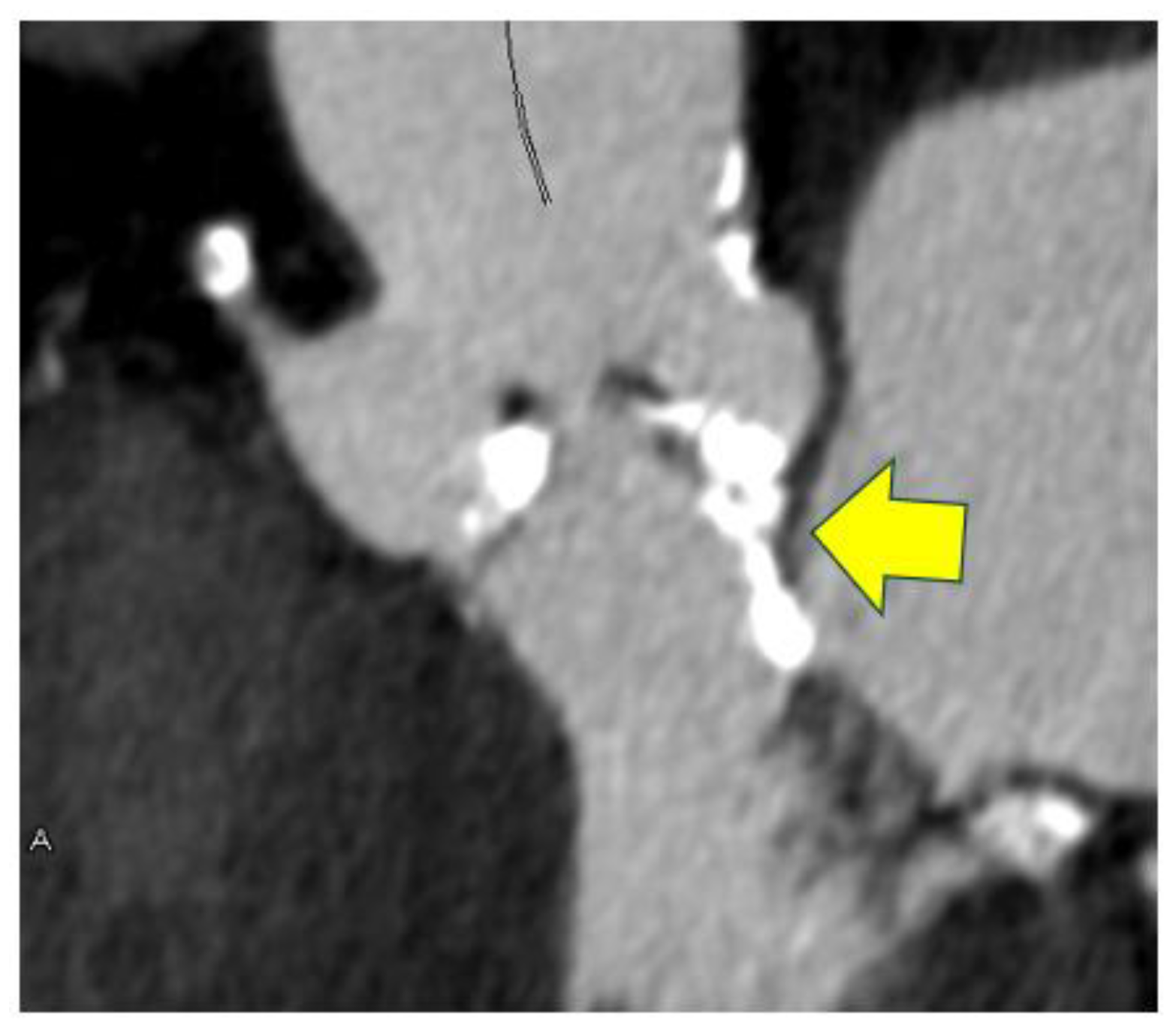 Tomography 11 00062 g007