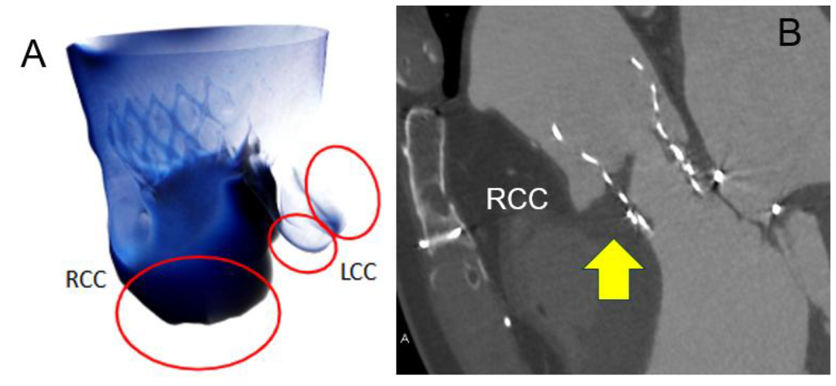 Tomography 11 00062 g008