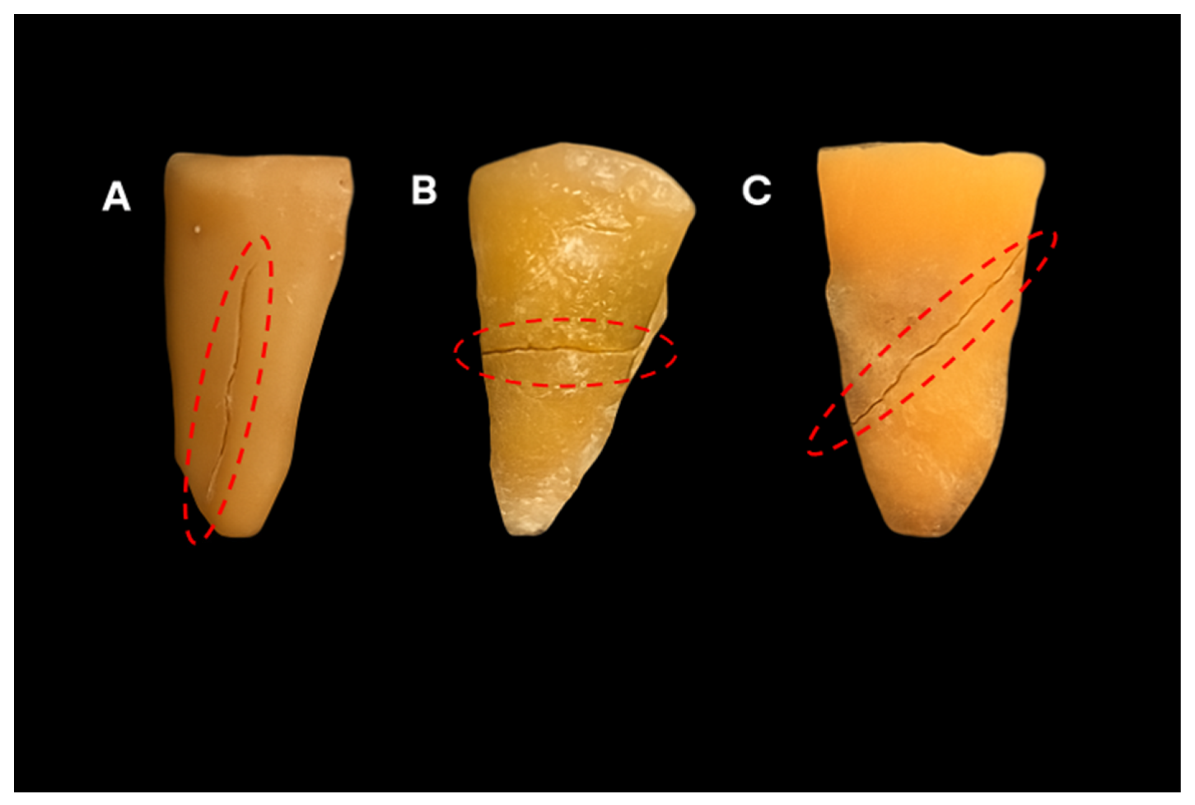 Tomography 11 00116 g001 Tomography 11 00116 g001