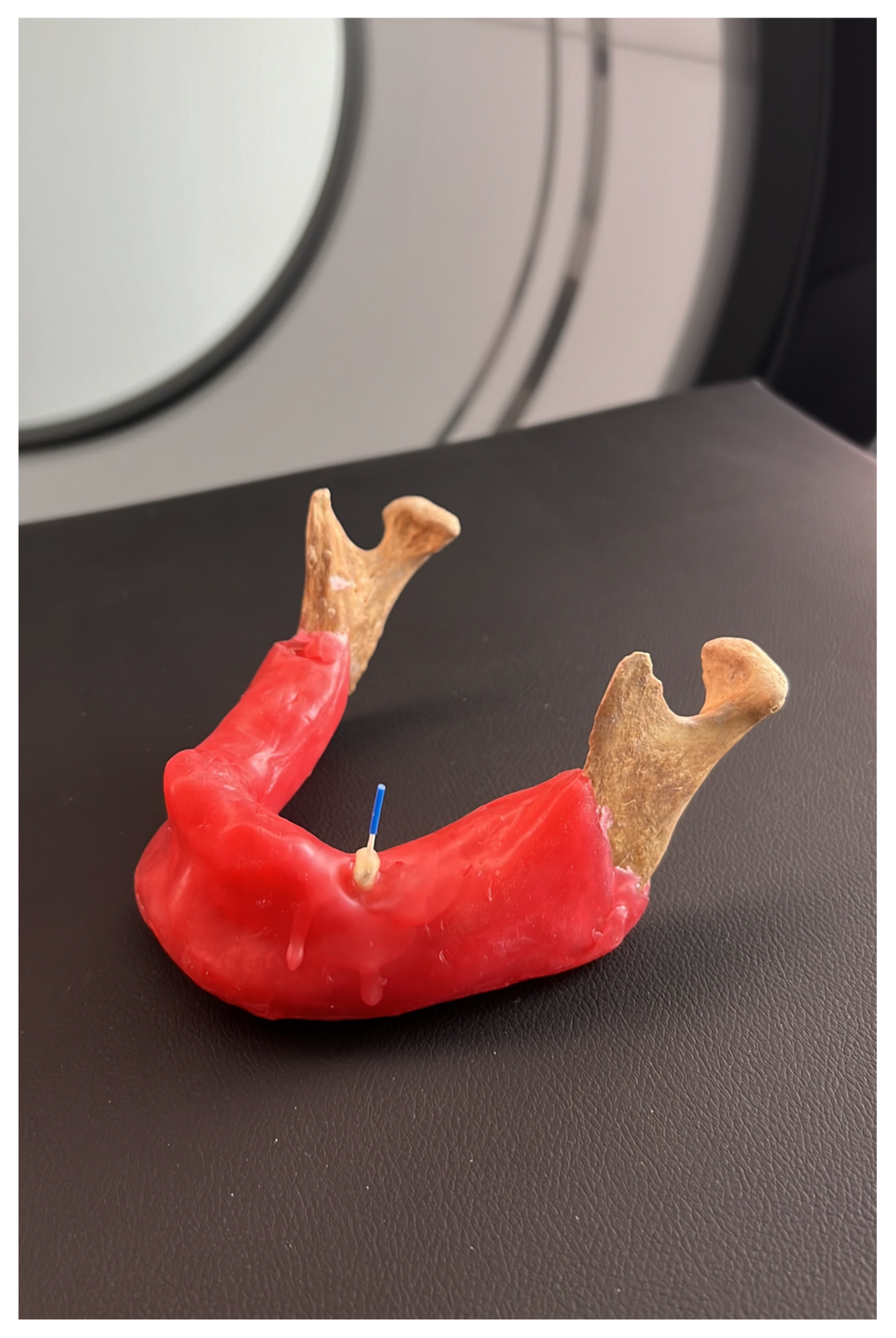 Tomography 11 00116 g002 Tomography 11 00116 g002