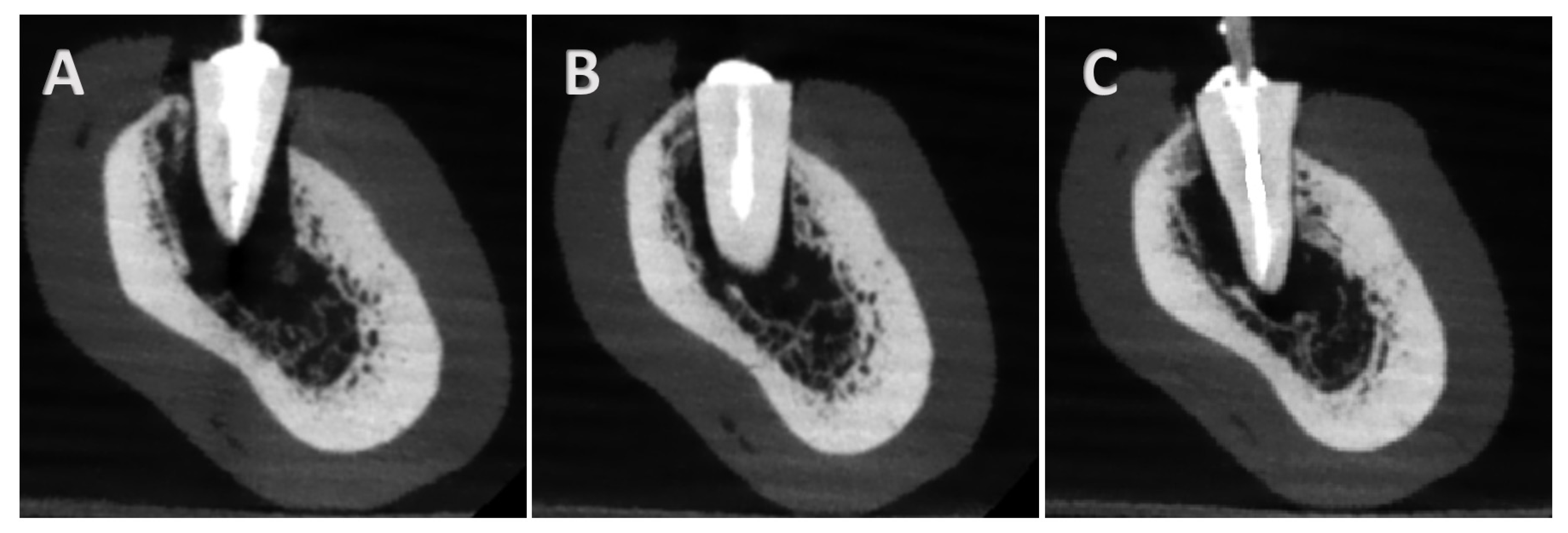 Tomography 11 00116 g004 Tomography 11 00116 g004
