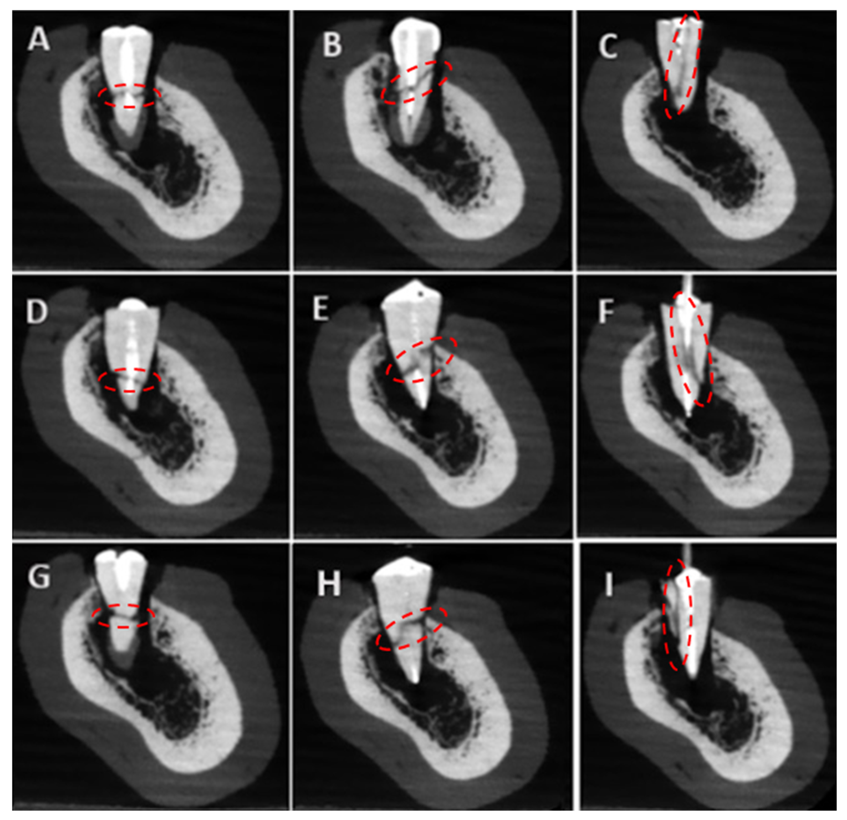 Tomography 11 00116 g005 Tomography 11 00116 g005