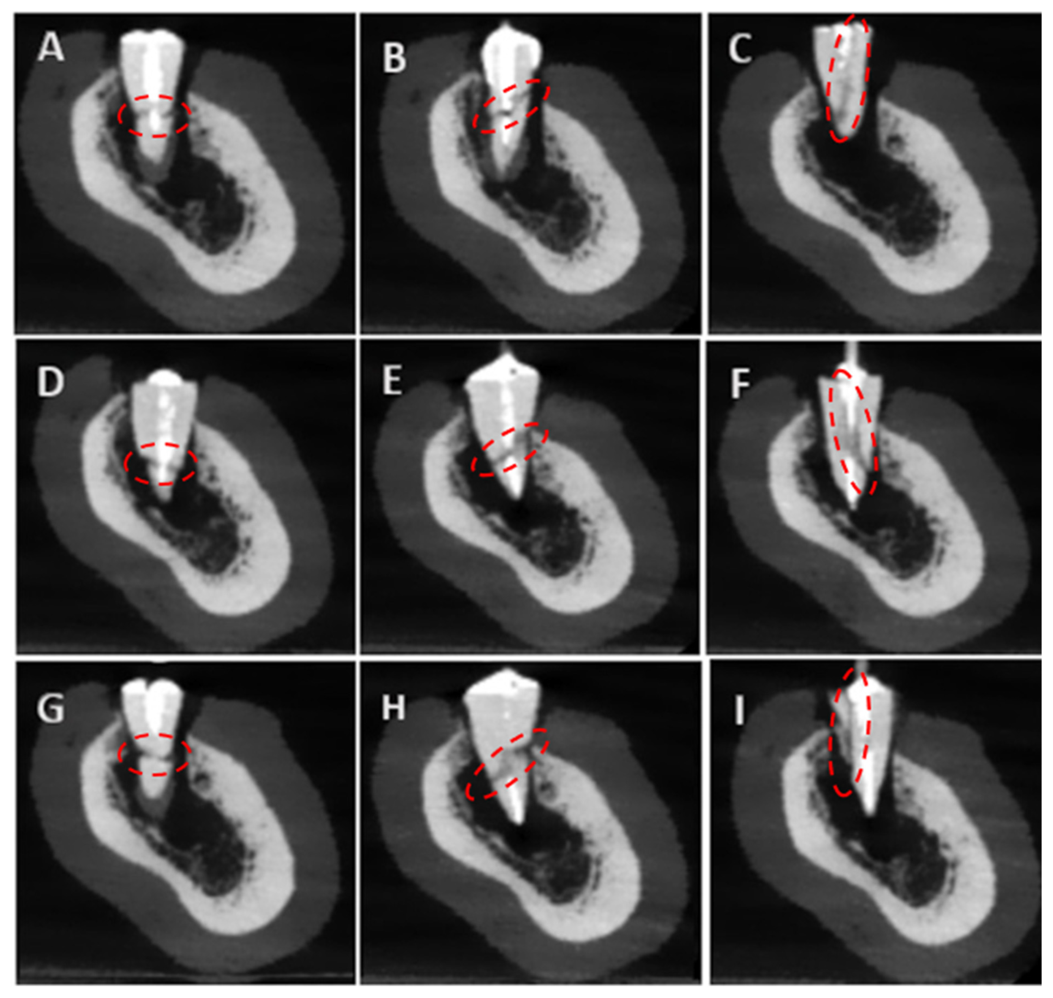 Tomography 11 00116 g006 Tomography 11 00116 g006