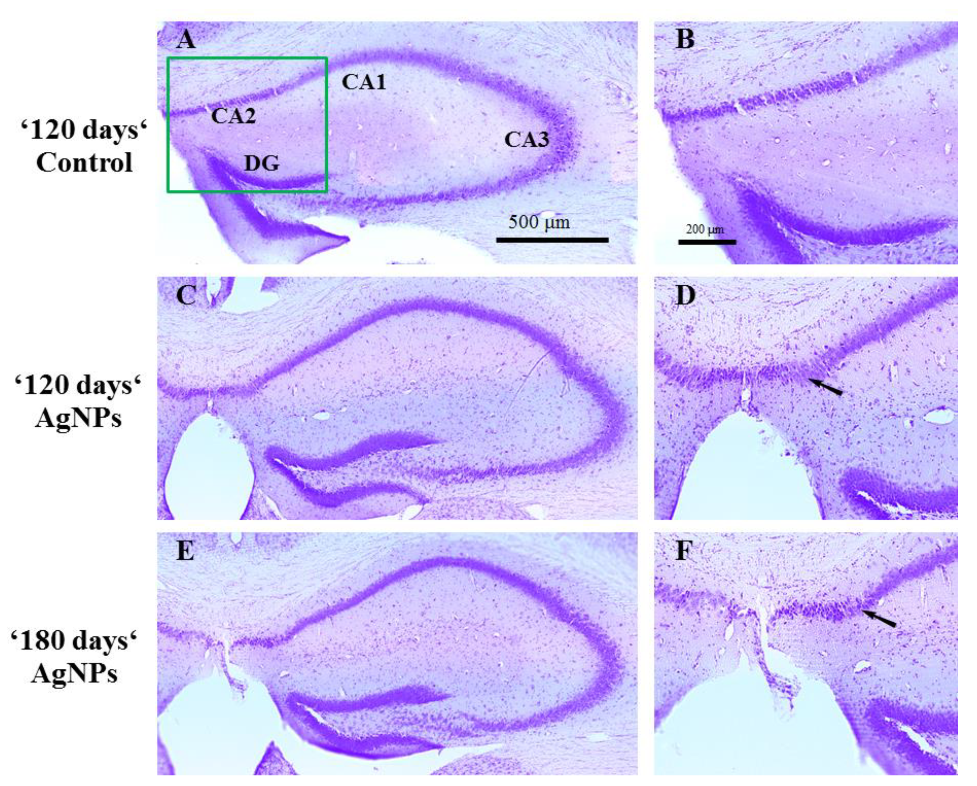Toxics 09 00030 g005 Toxics 09 00030 g005