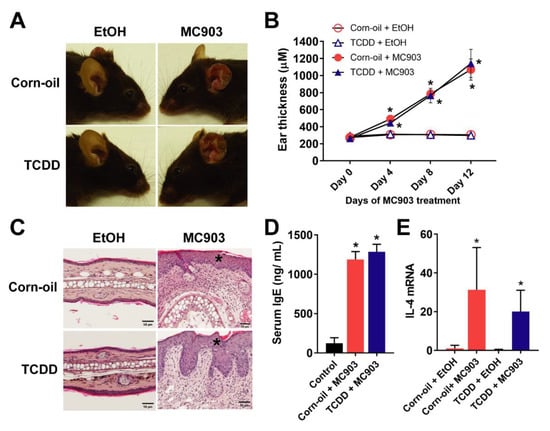 Toxics Free Full Text Cutaneous Effects Of In Utero And Lactational Exposure Of C57bl 6j Mice To 2 3 7 8 Tetrachlorodibenzo P Dioxin Html