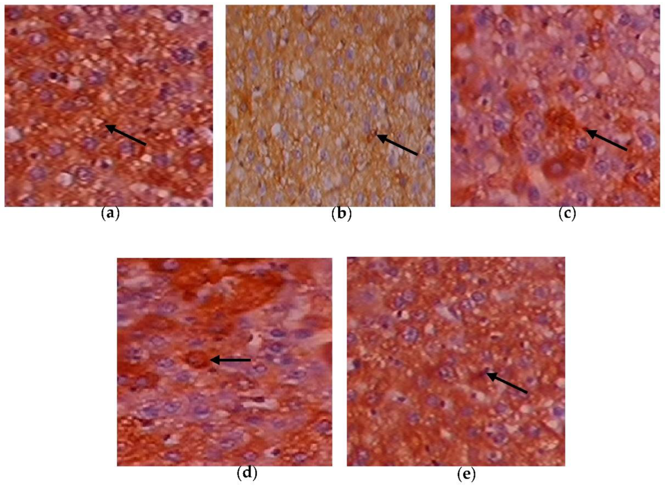 Toxics 11 00240 g011