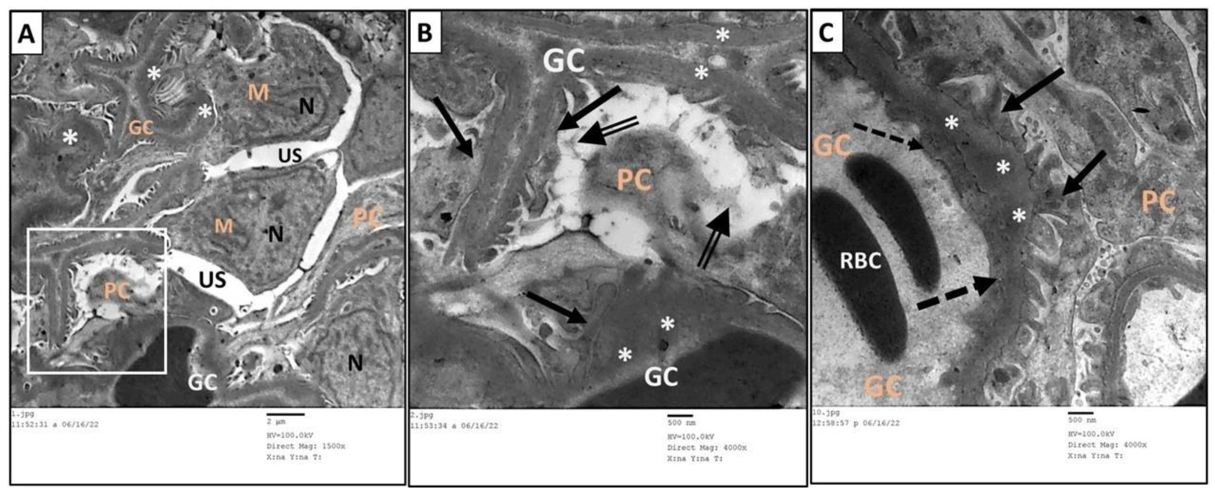 Toxics 11 00398 g011 Toxics 11 00398 g011