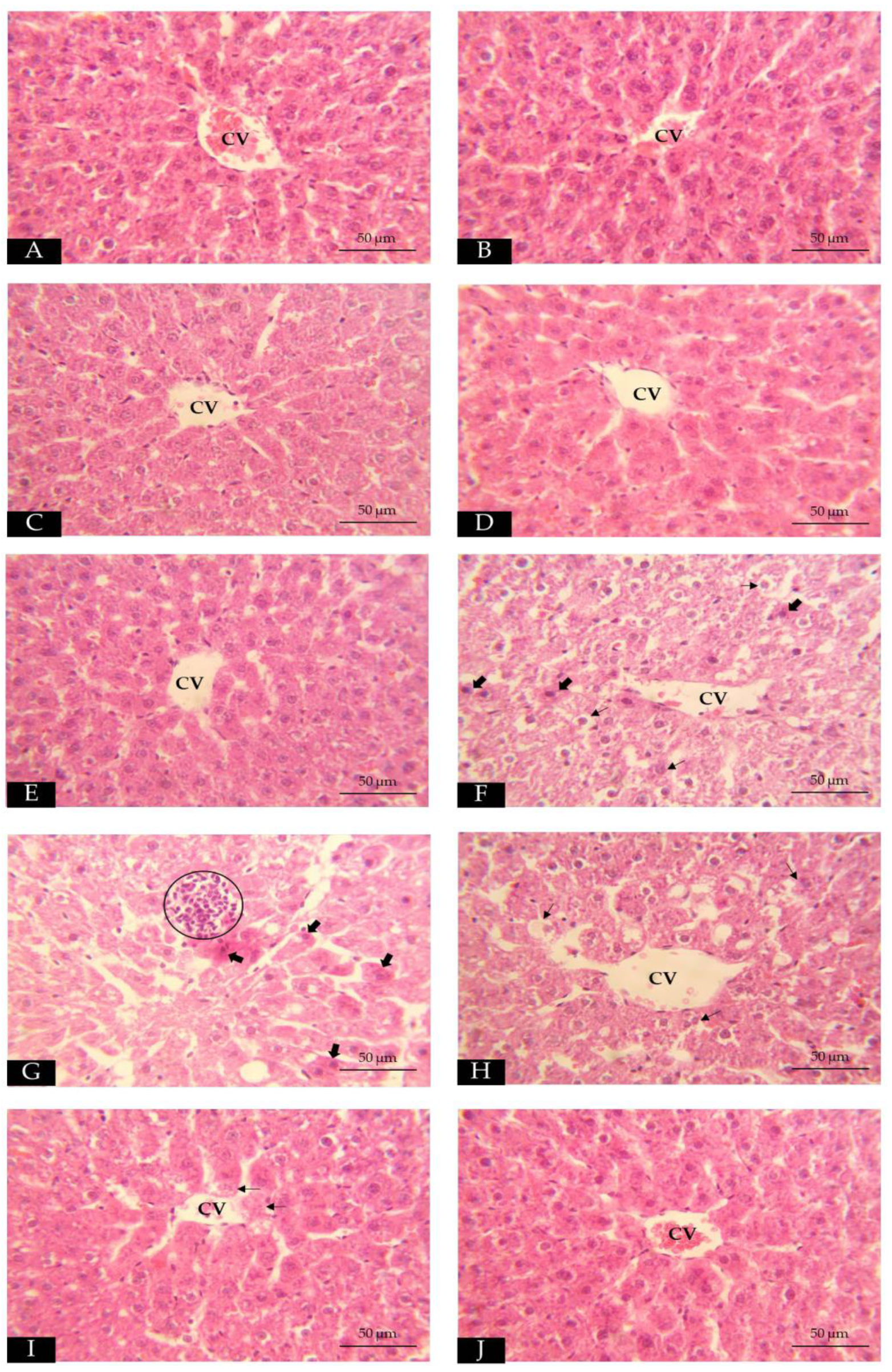 Toxics 11 00480 g004 Toxics 11 00480 g004