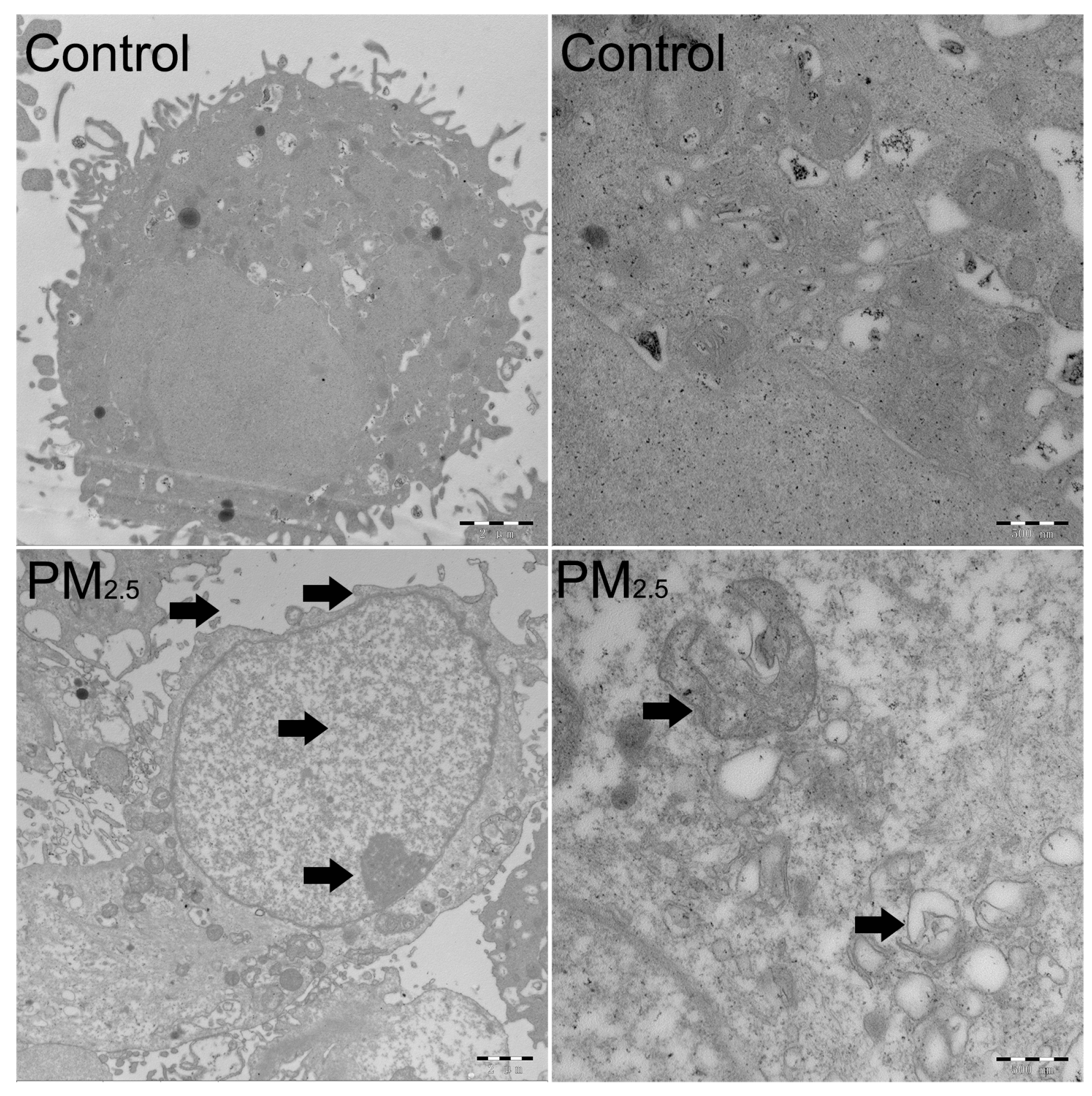 Toxics 11 00562 g002 Toxics 11 00562 g002