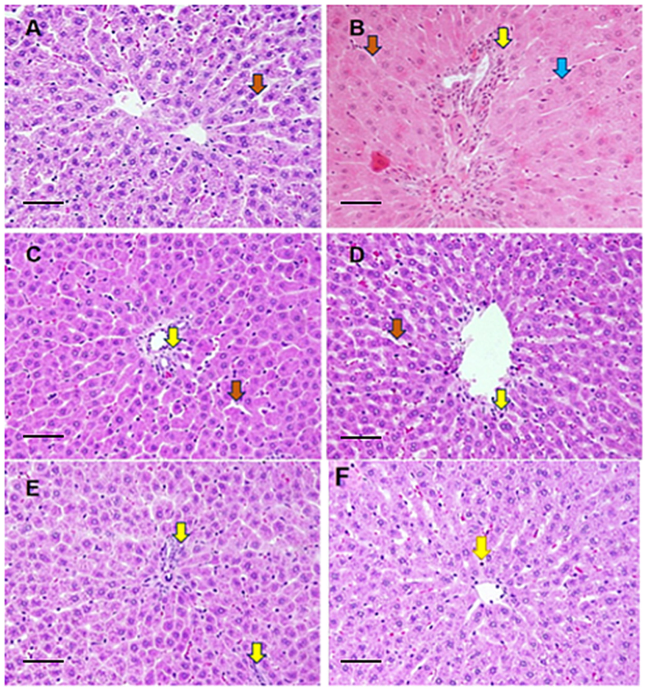 Toxics 11 00867 g005