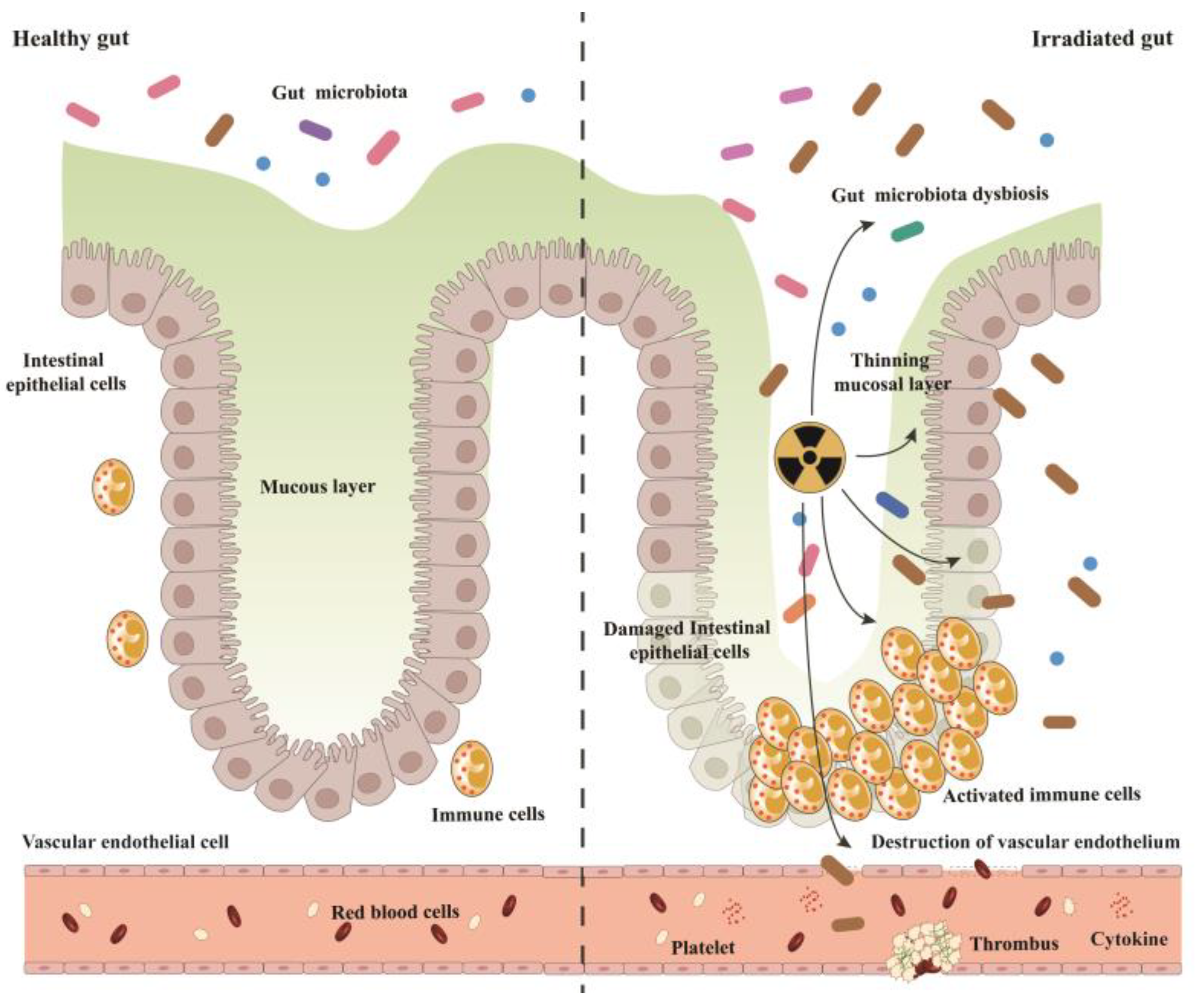 Toxics | Free Full-Text | Radiation-Induced Intestinal Injury: Injury ...