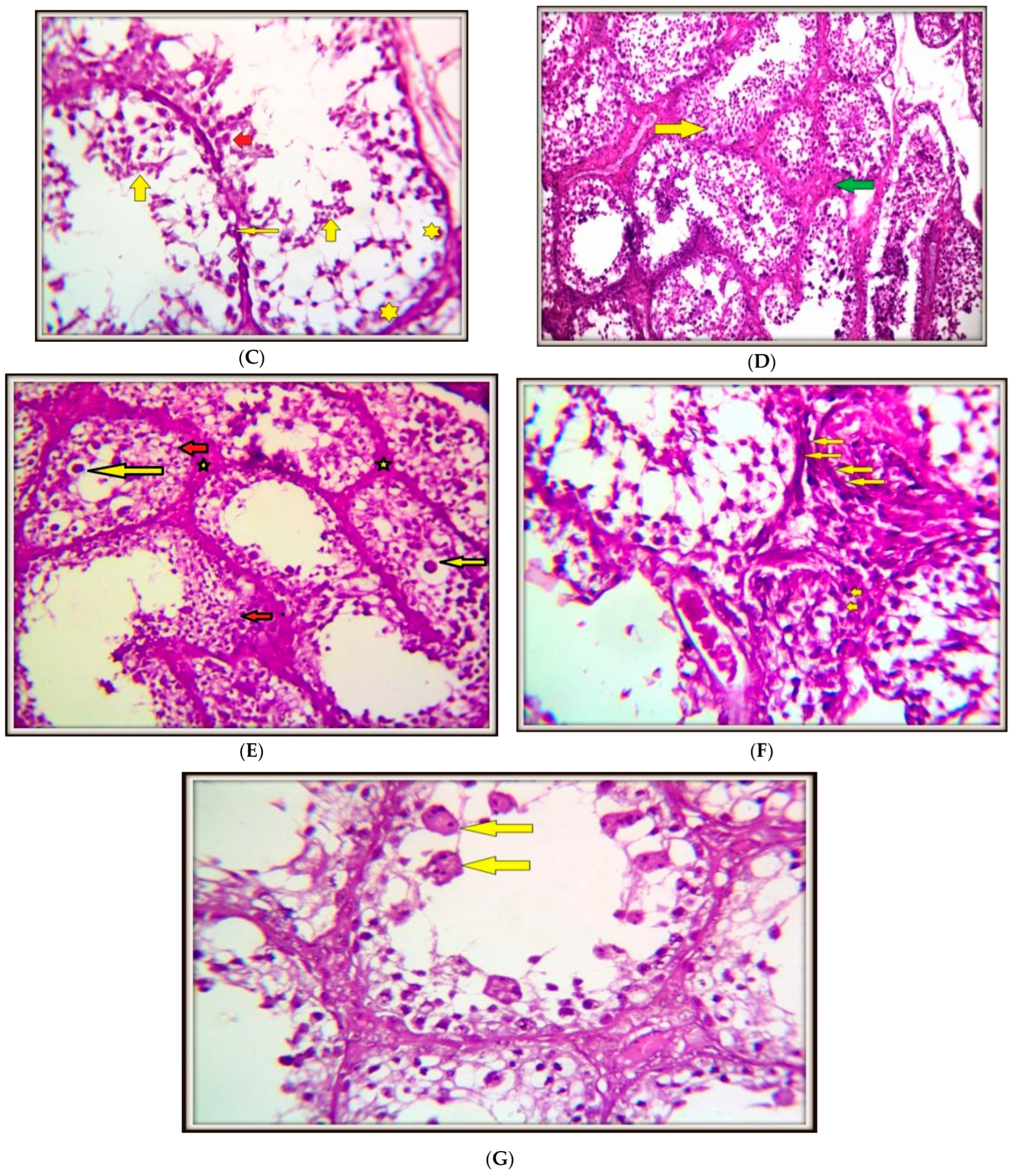 Toxics 13 00323 g002b Toxics 13 00323 g002b