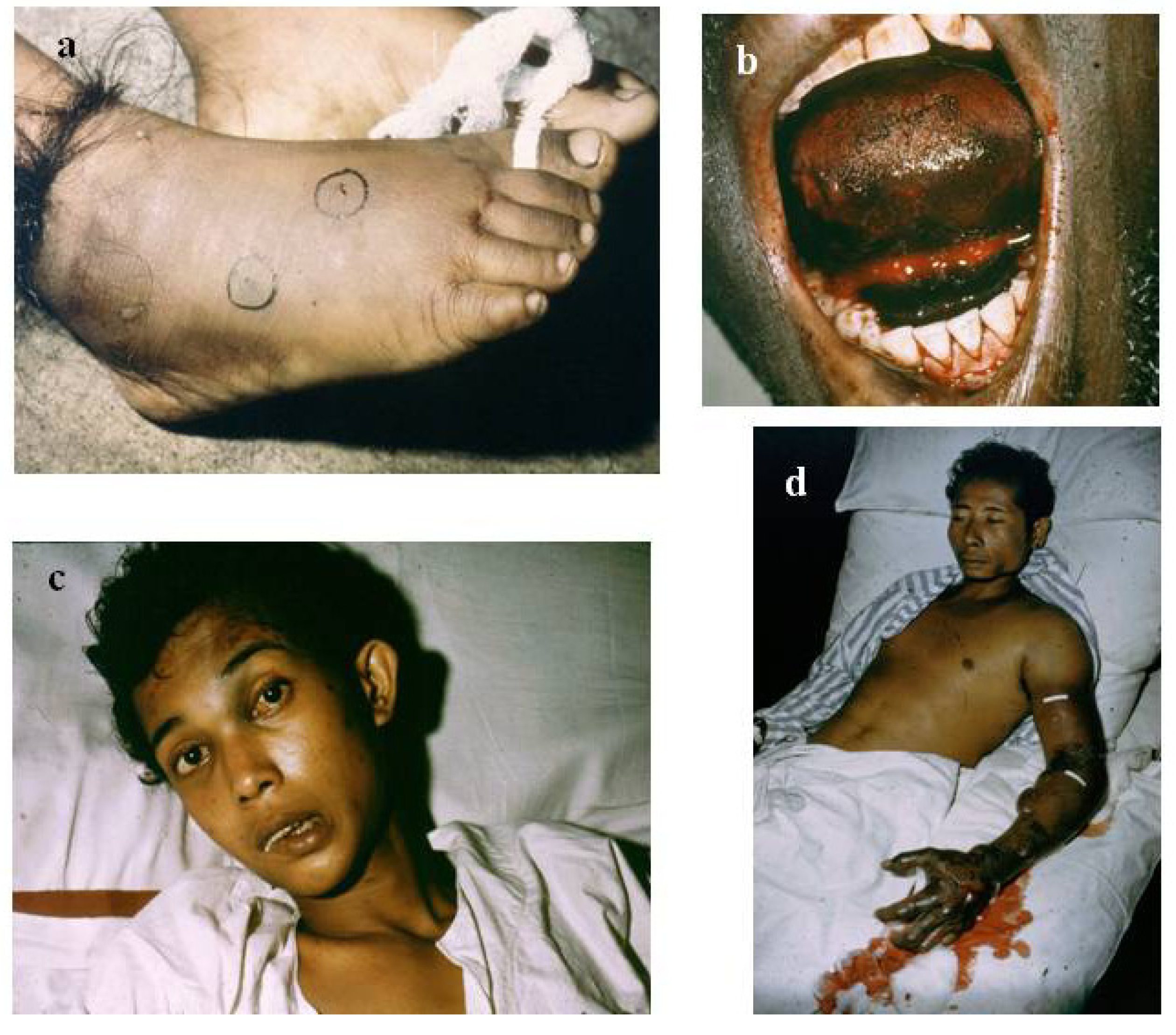 Toxins 06 01667 g002