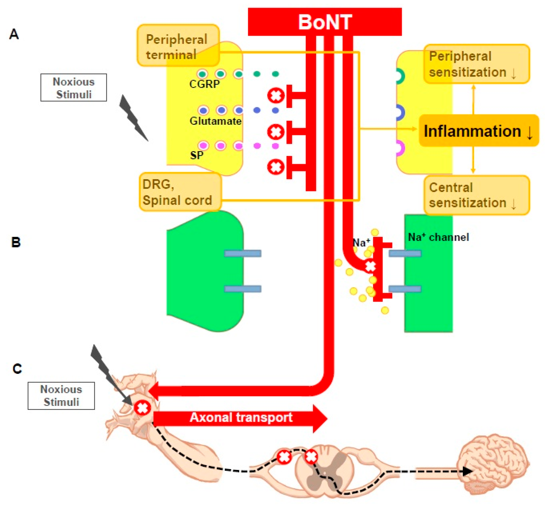 Toxins | Free Full-Text | Botulinum Toxin for the Treatment of Neuropathic  Pain