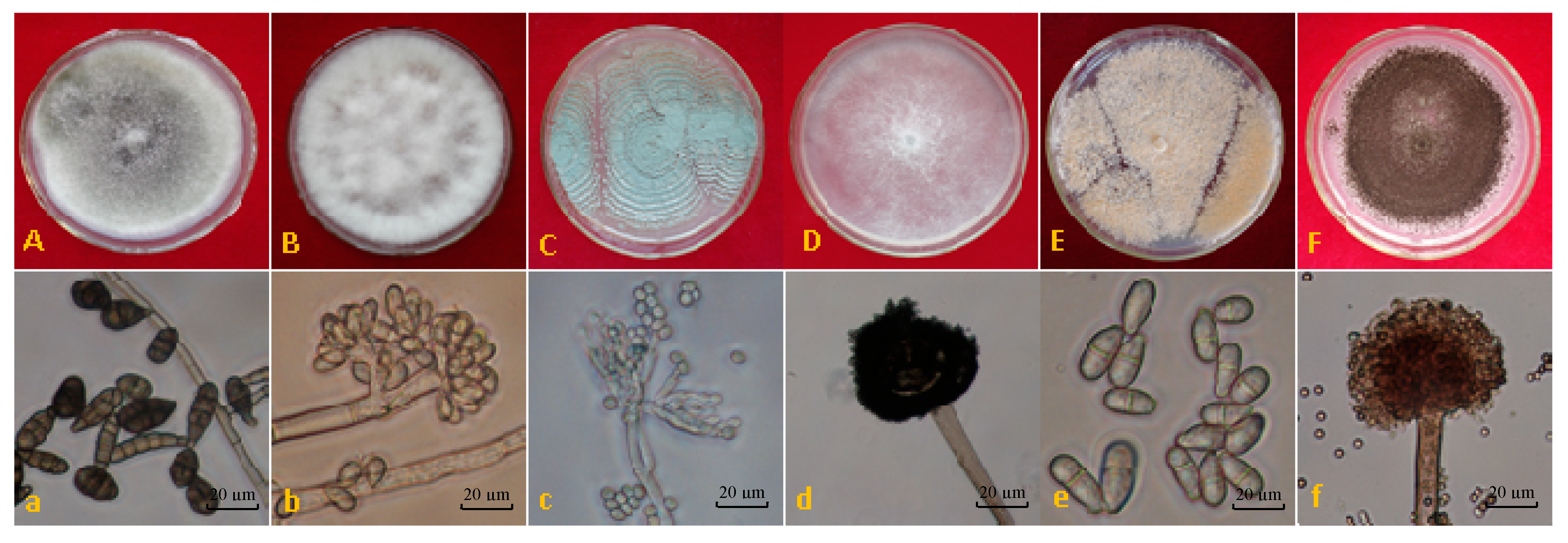 Toxins 11 00322 g001