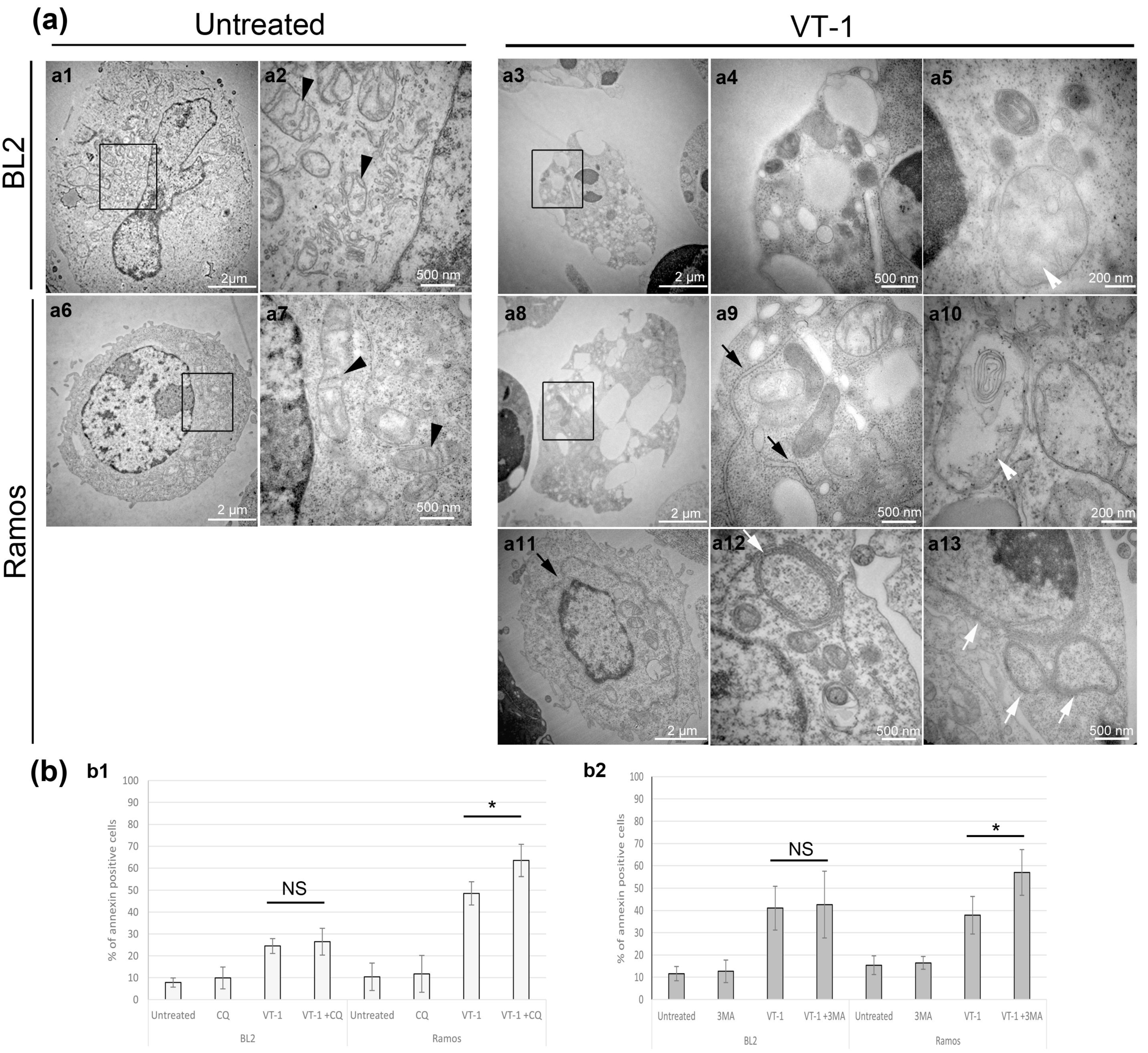 Toxins | Free Full-Text | Verotoxin-1-Induced ER Stress Triggers Apoptotic  or Survival Pathways in Burkitt Lymphoma Cells