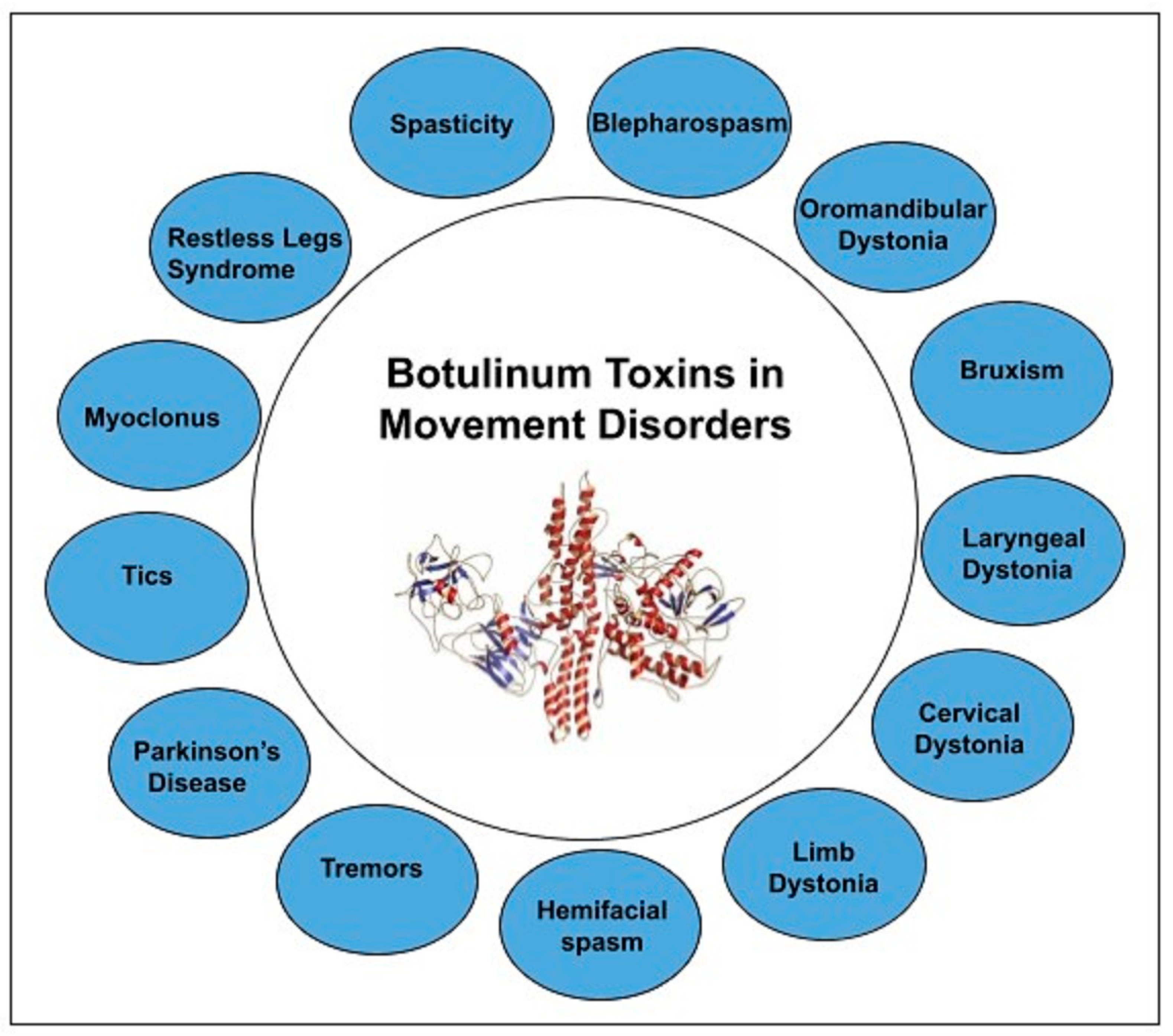 Toxins | Free Full-Text | Botulinum Toxin in Movement Disorders: An Update