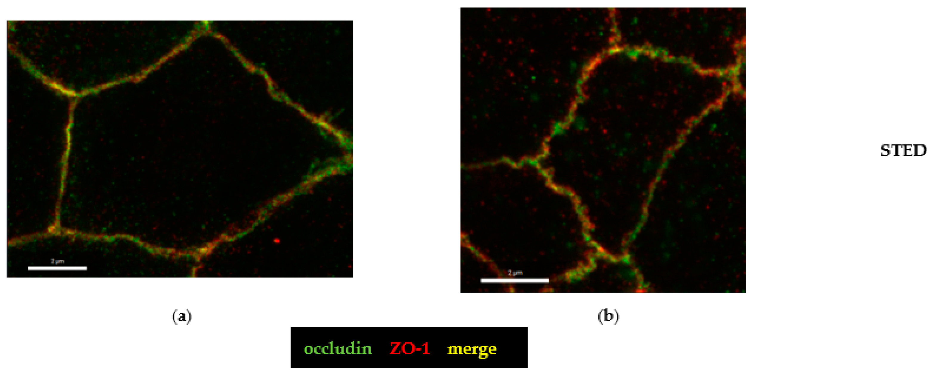 Toxins 15 00054 g008 Toxins 15 00054 g008