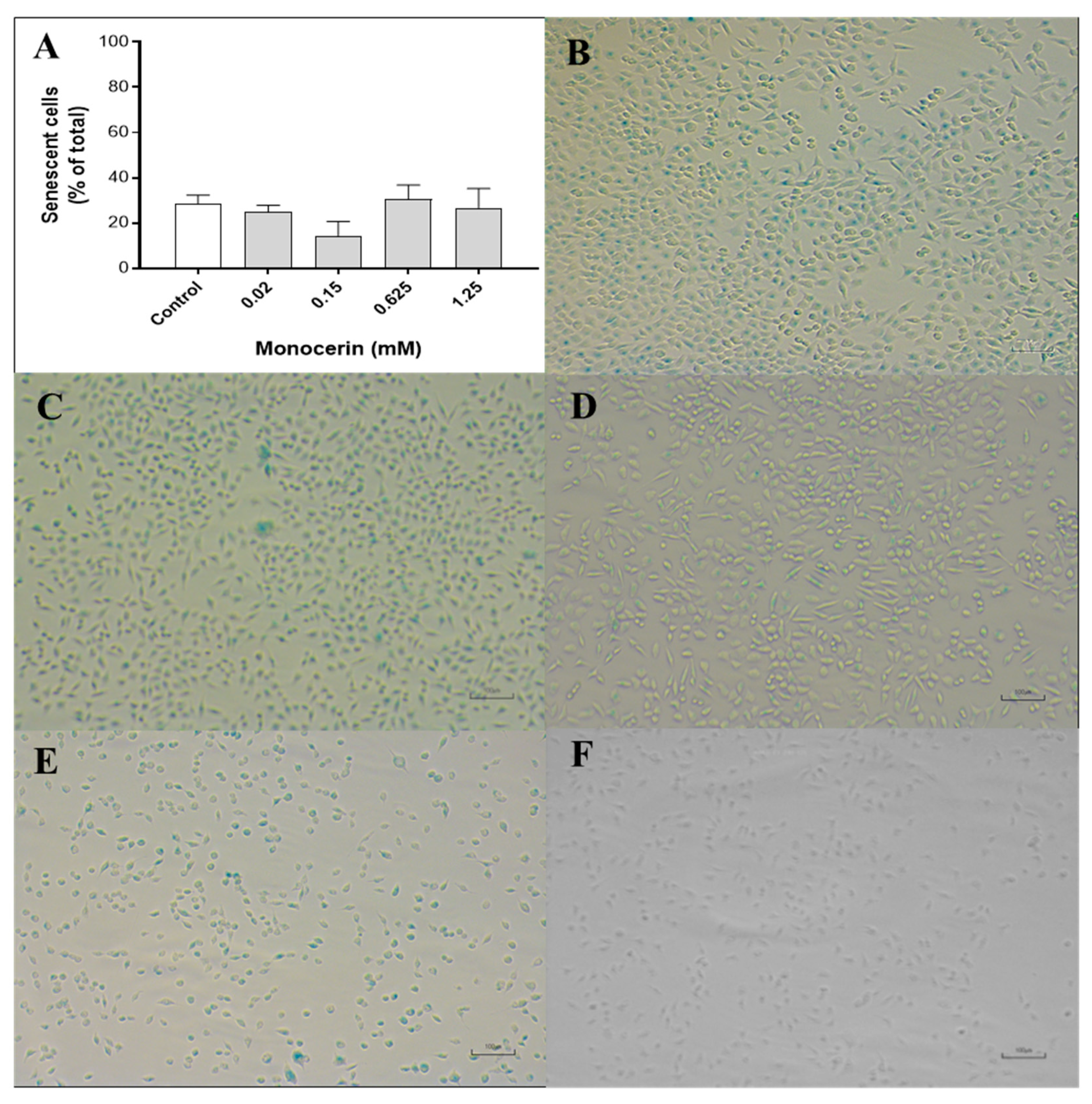 Toxins 15 00344 g006