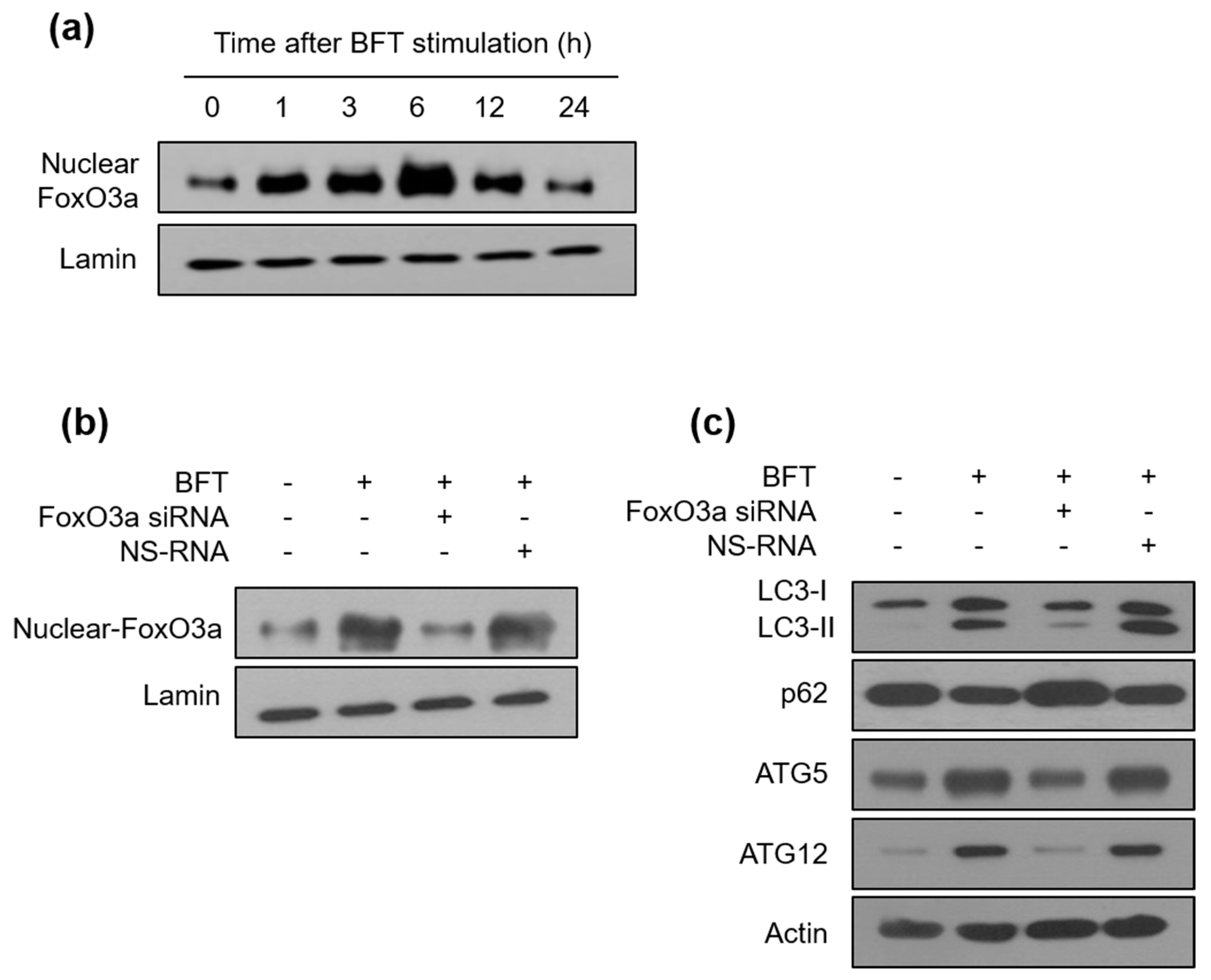 Toxins 15 00544 g004 Toxins 15 00544 g004