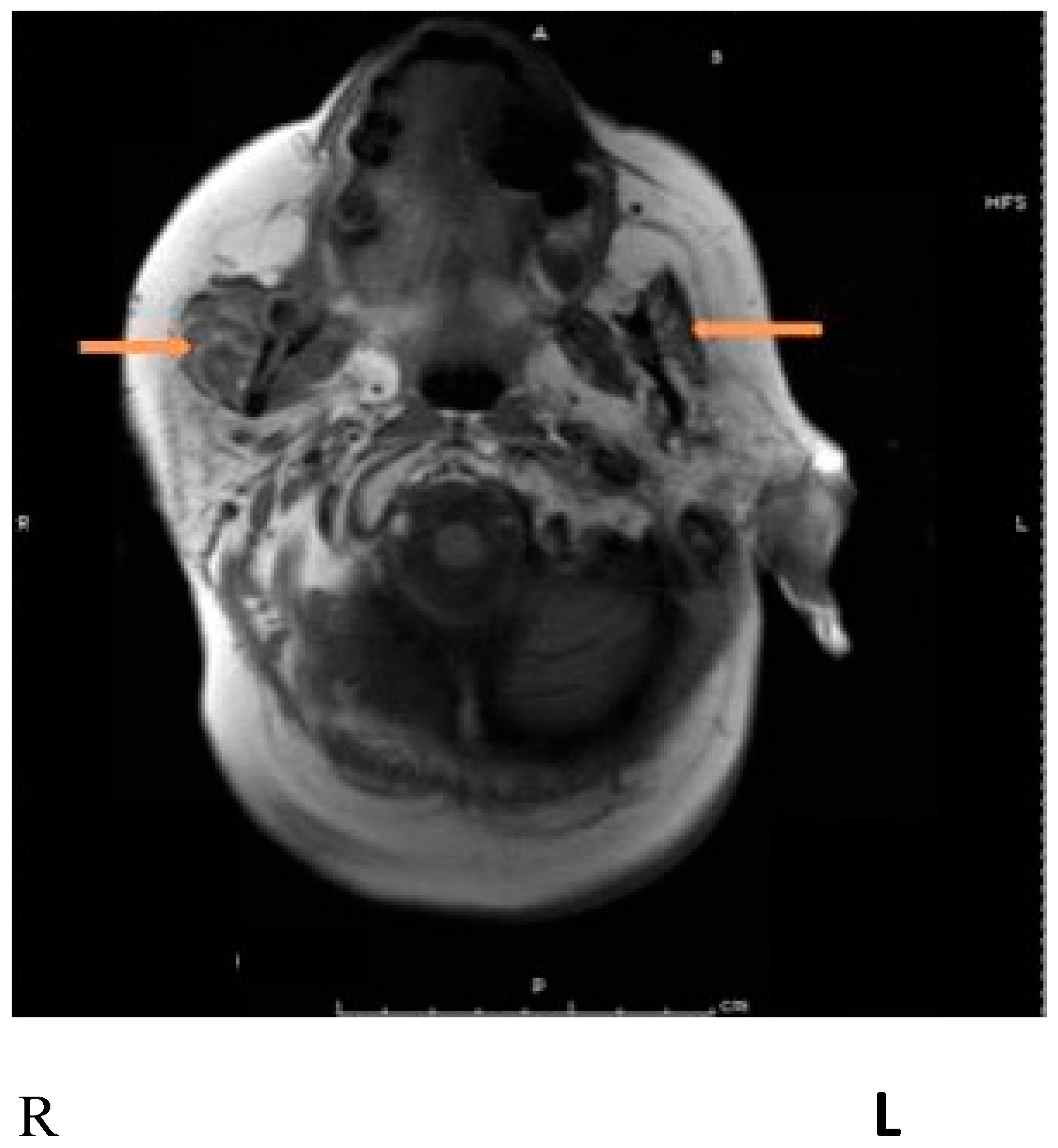 Toxins 15 00689 g002 Toxins 15 00689 g002