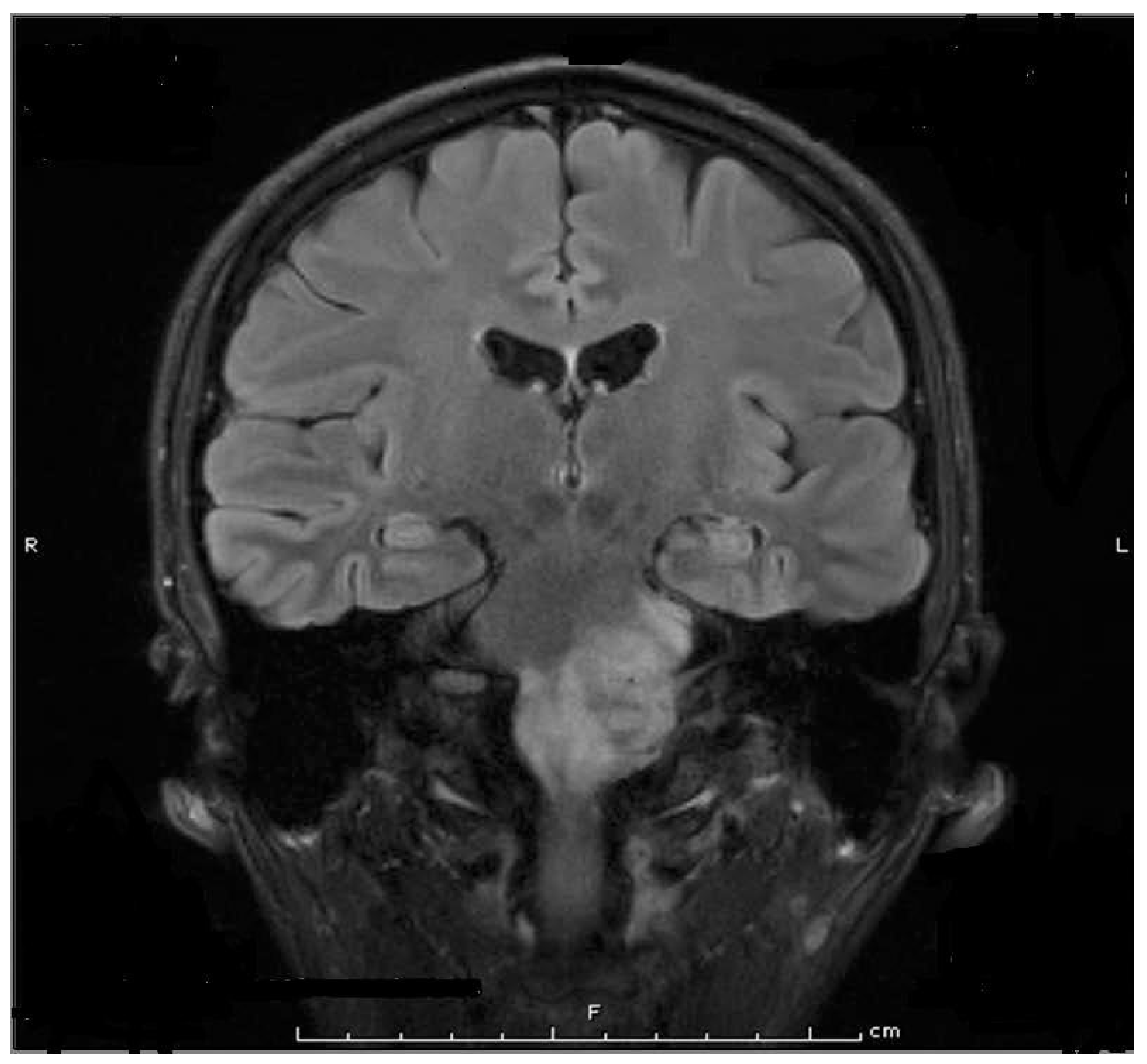 Toxins 15 00689 g003 Toxins 15 00689 g003