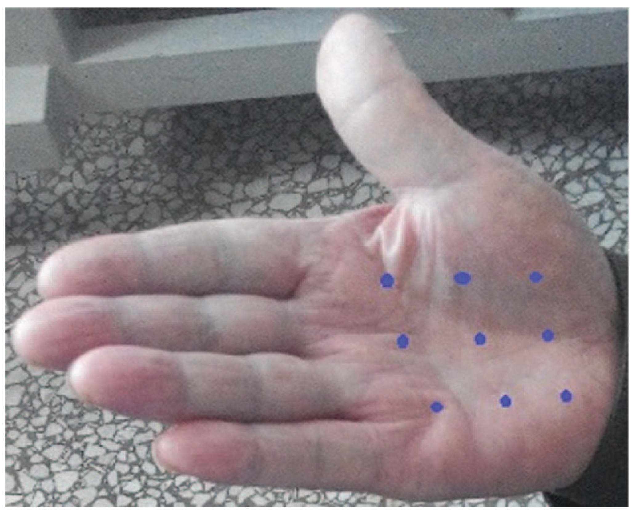 Toxins 15 00689 g004 Toxins 15 00689 g004